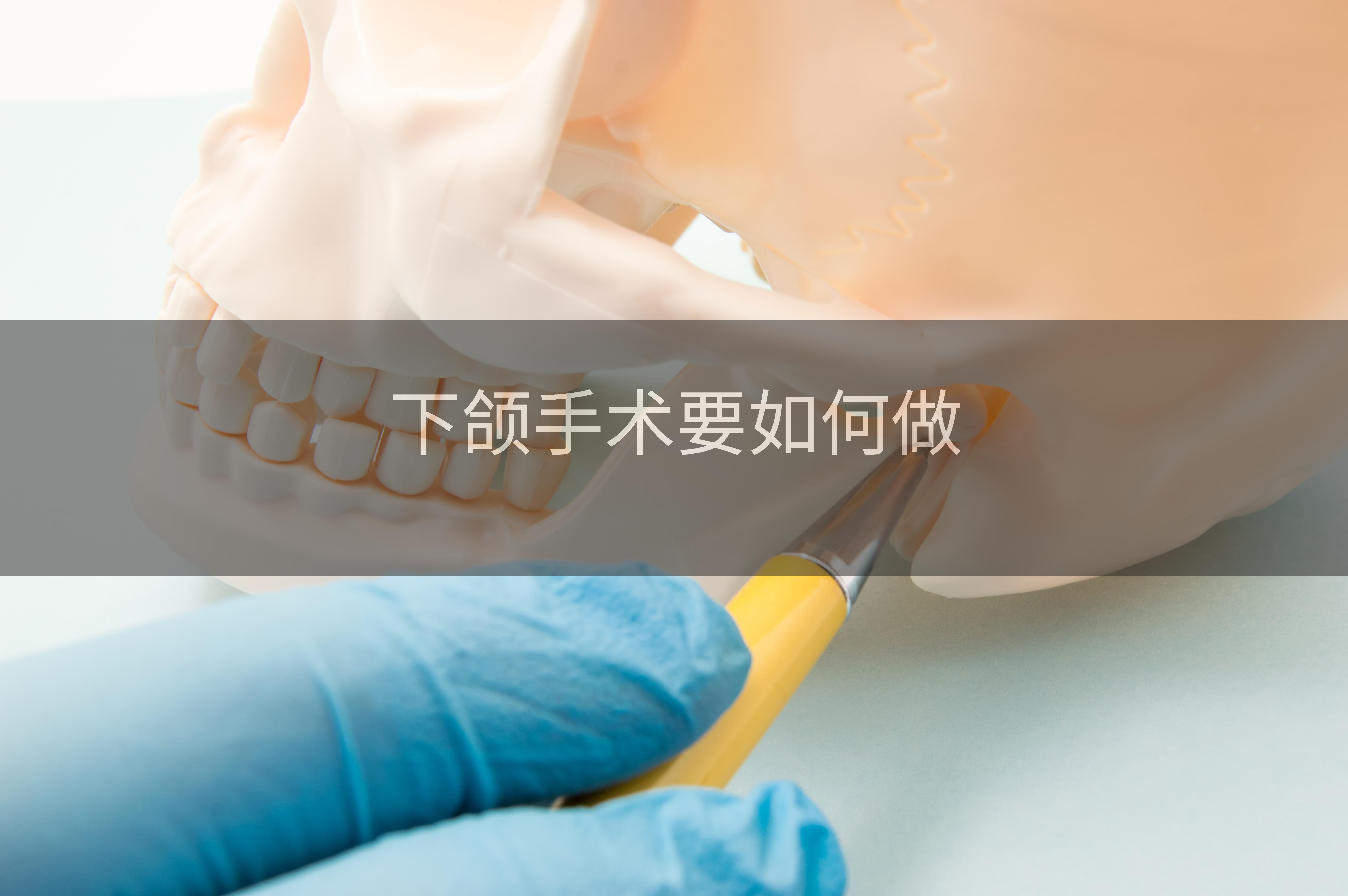 下颌手术要如何做