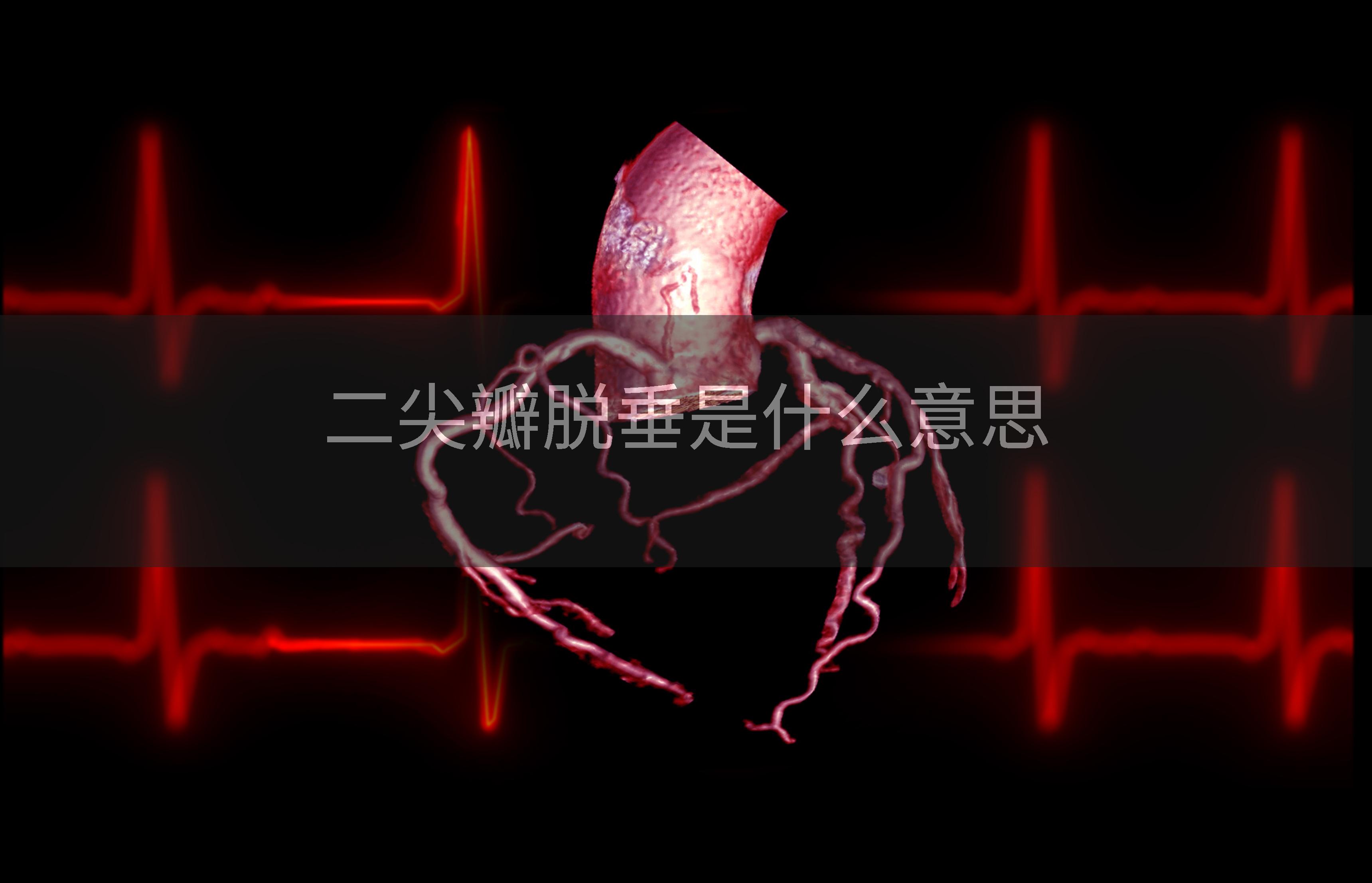 二尖瓣脱垂是什么意思