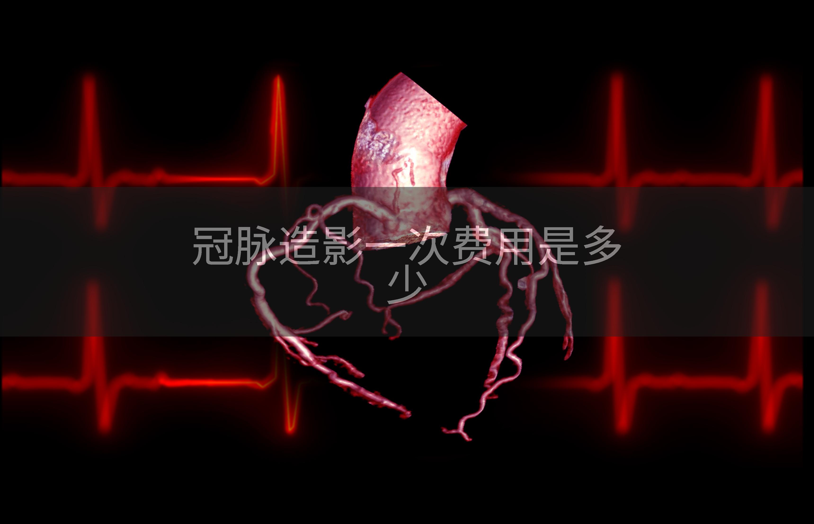冠脉造影一次费用是多少