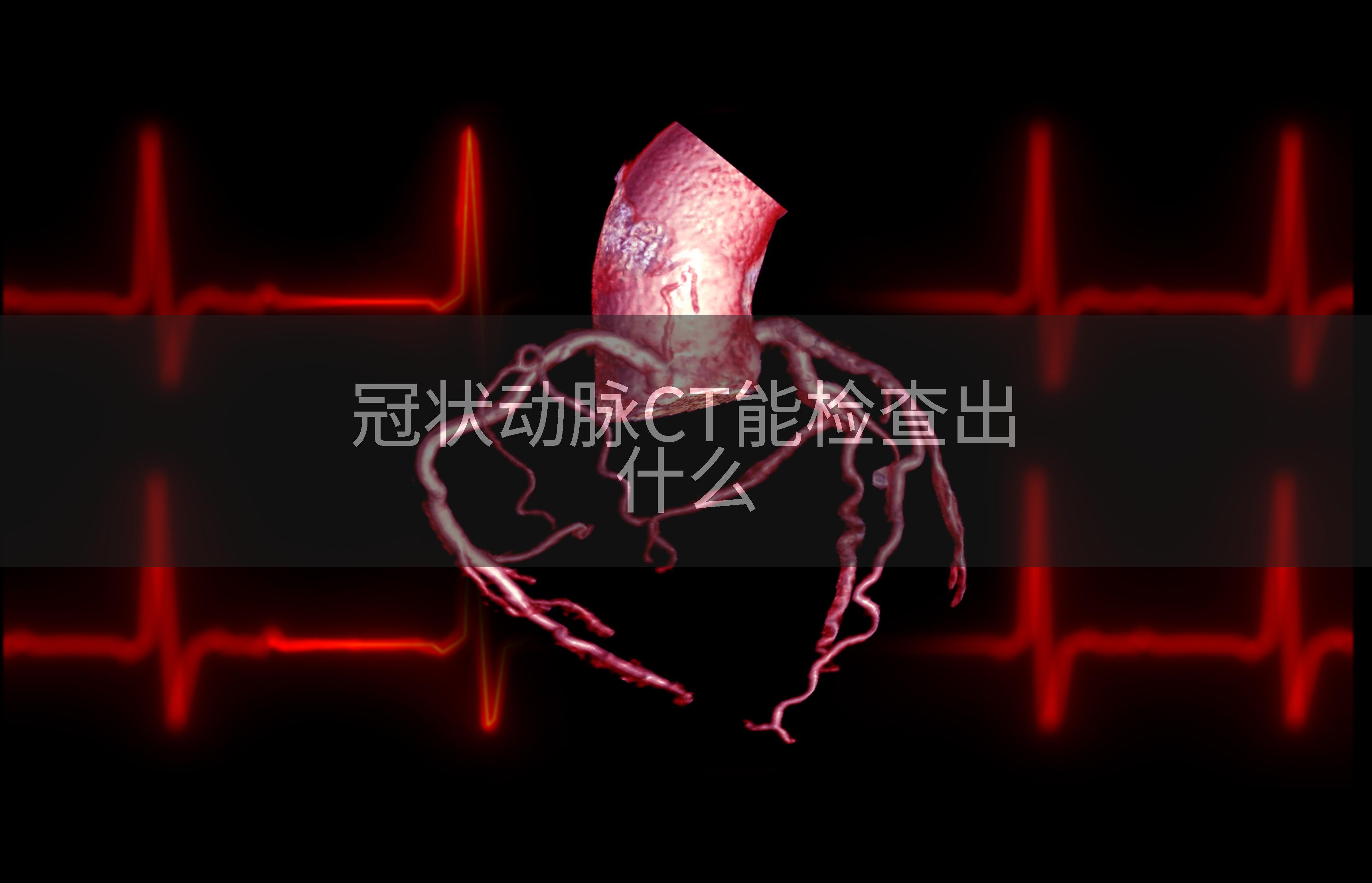 冠状动脉CT能检查出什么