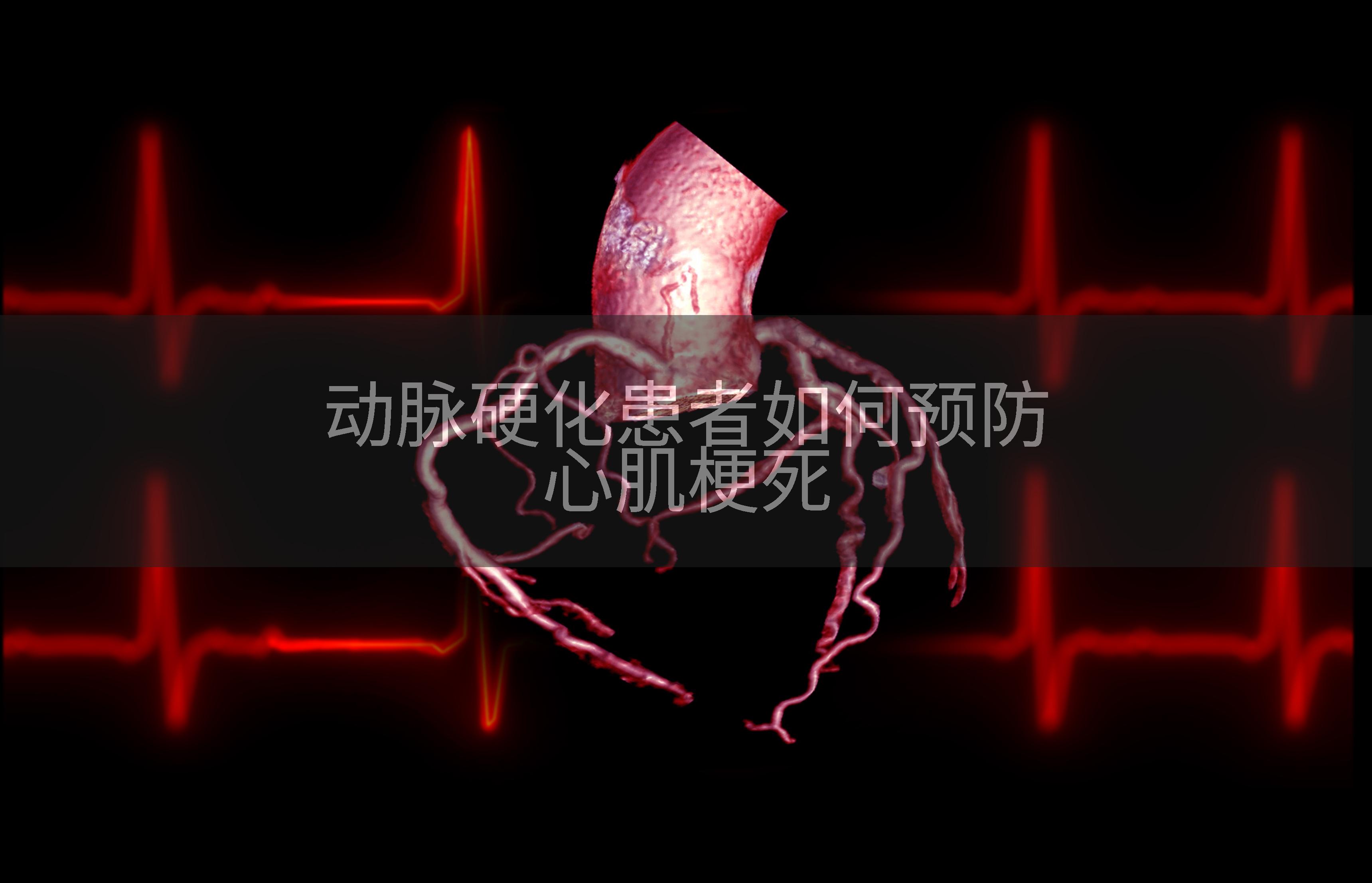 动脉硬化患者如何预防心肌梗死