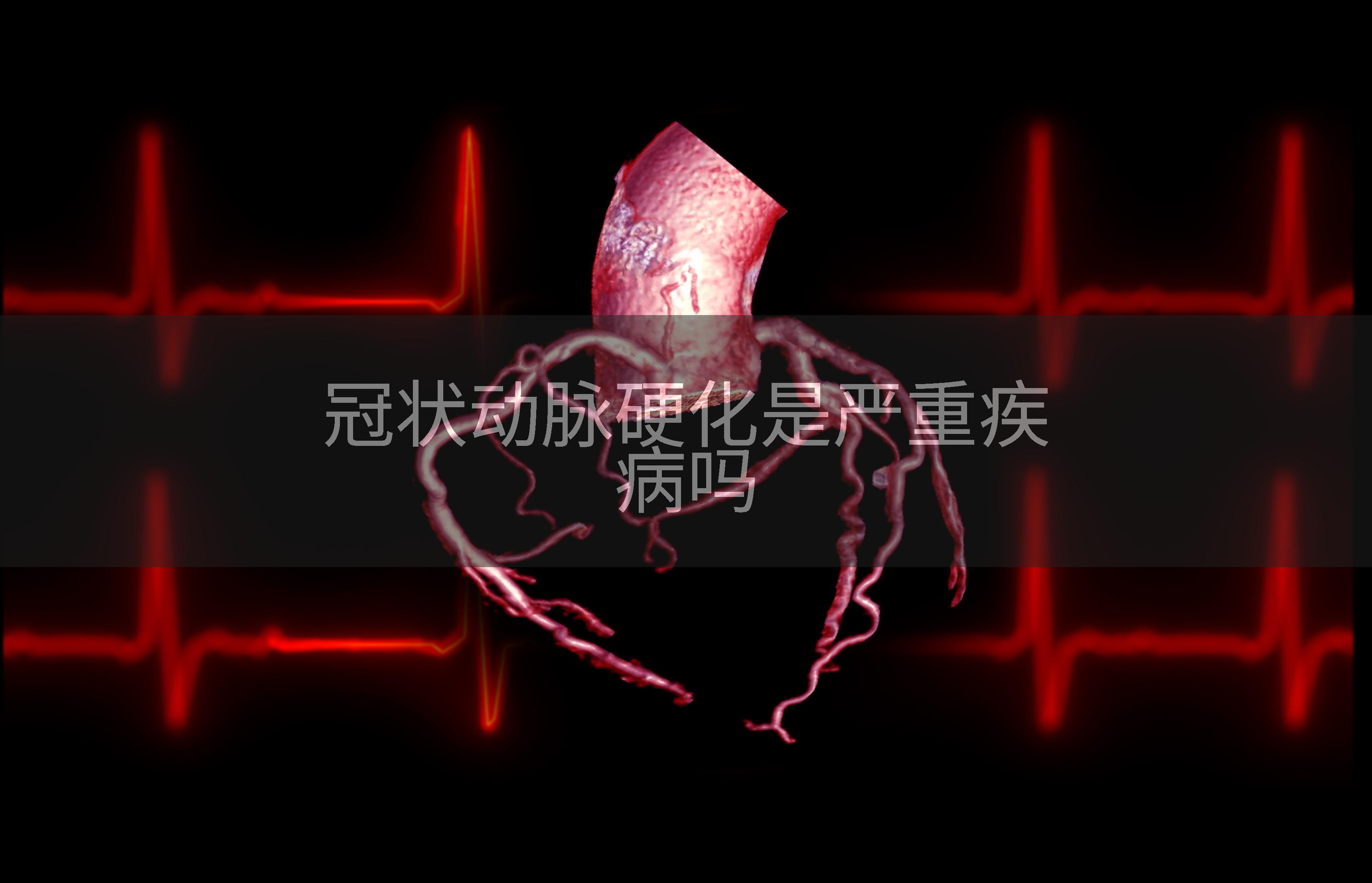 冠状动脉硬化是严重疾病吗