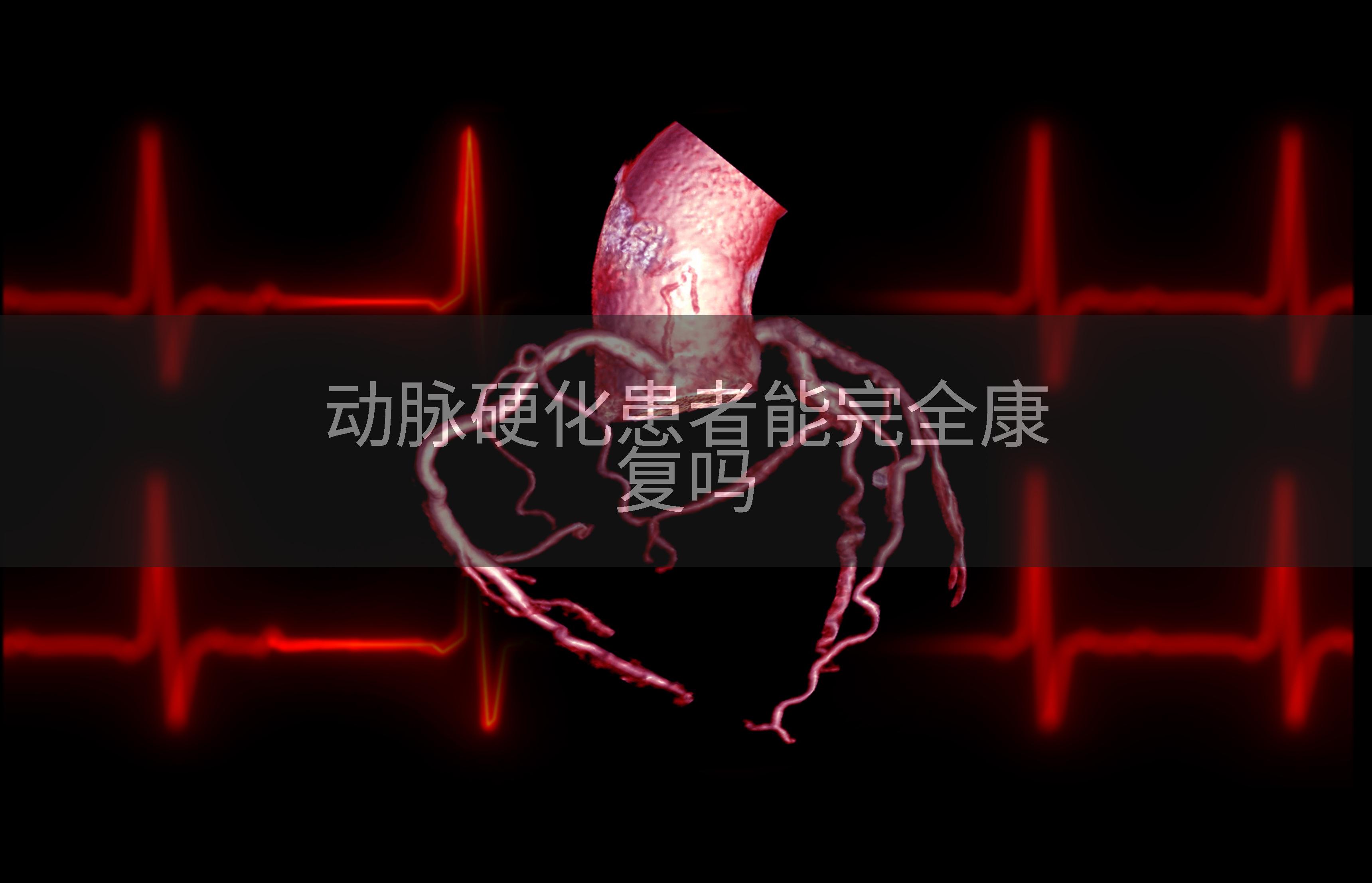 动脉硬化患者能完全康复吗