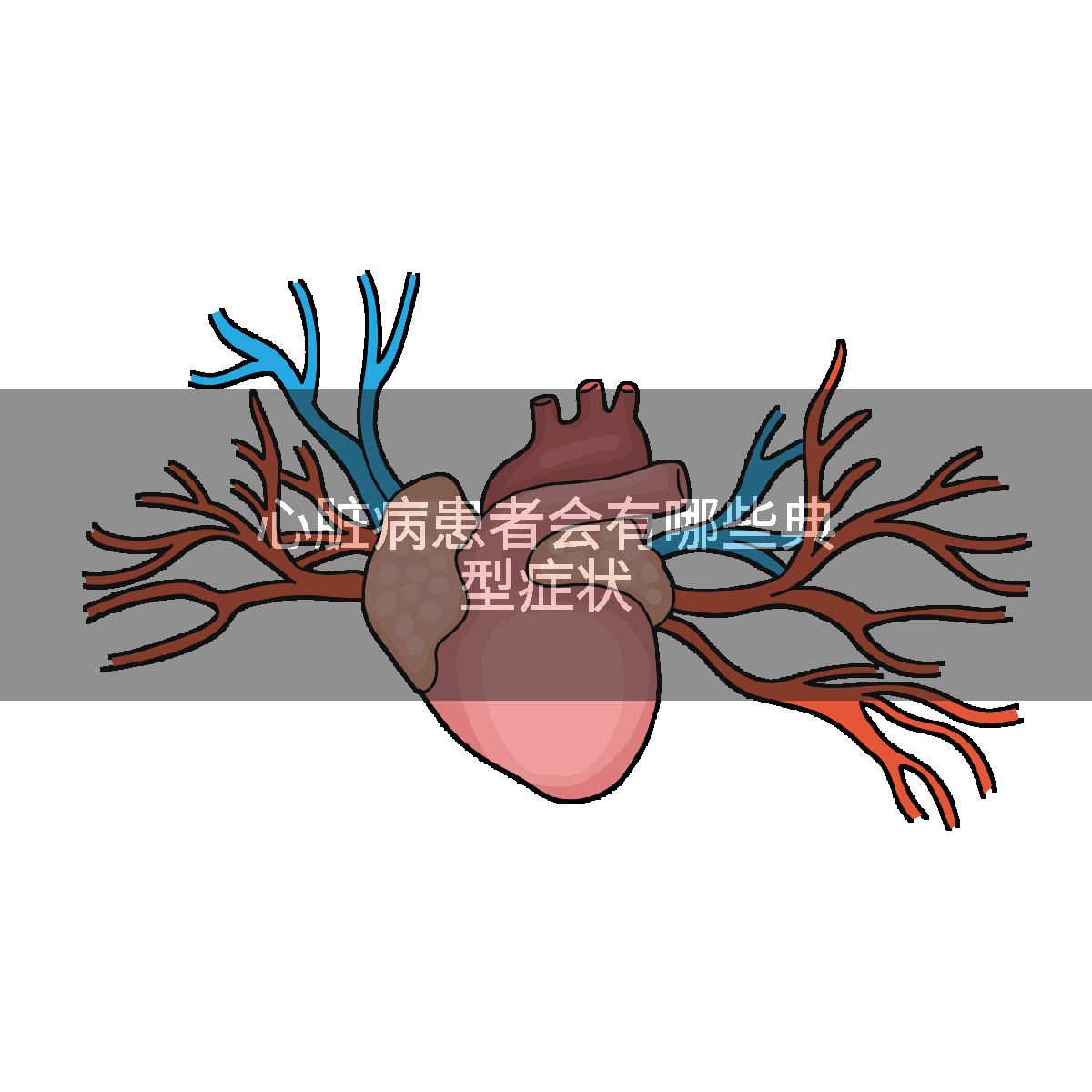 心脏病患者会有哪些典型症状