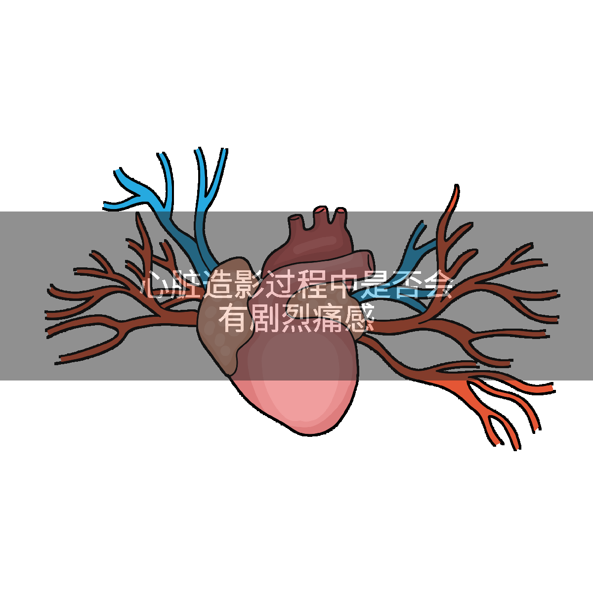 心脏造影过程中是否会有剧烈痛感
