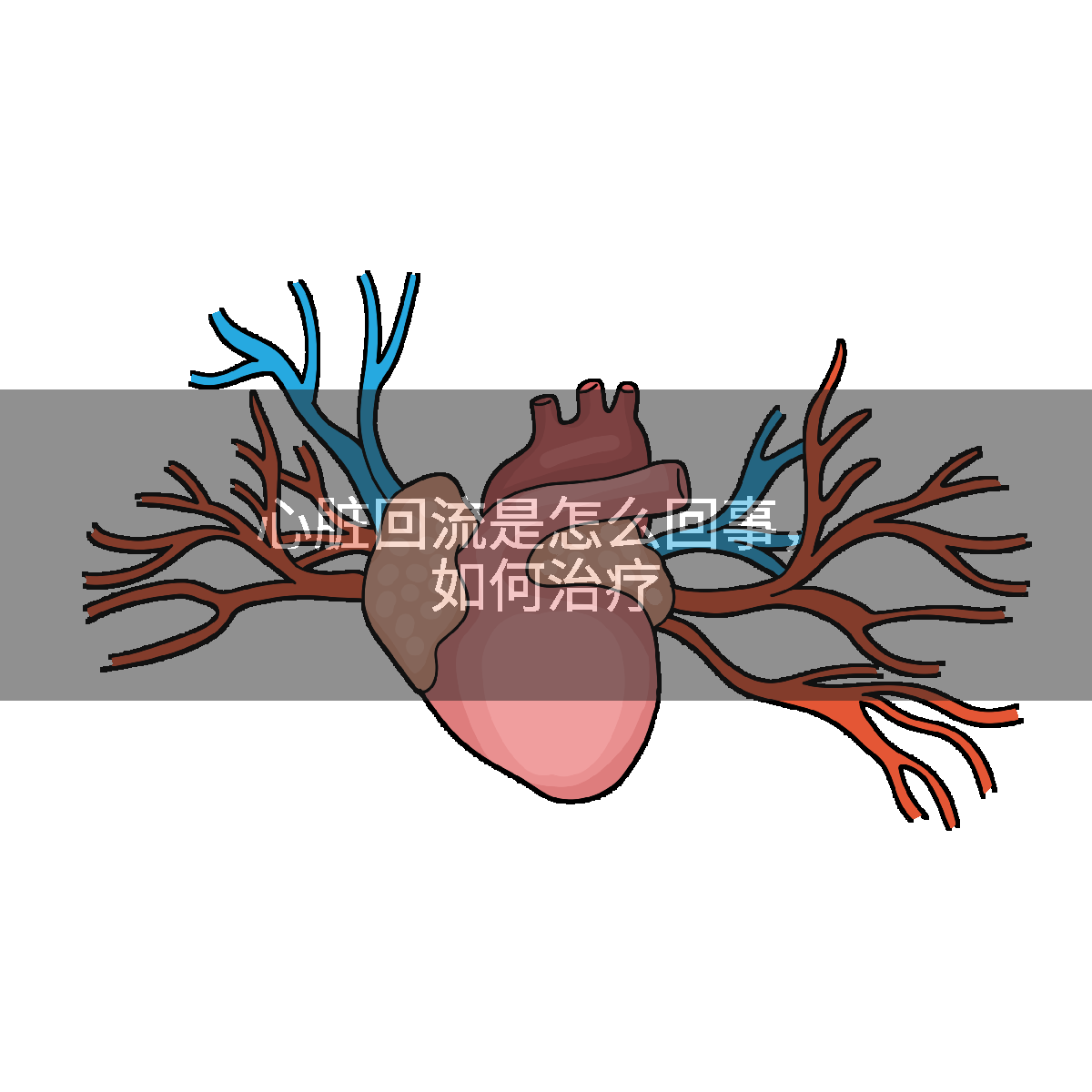 心脏回流是怎么回事,如何治疗
