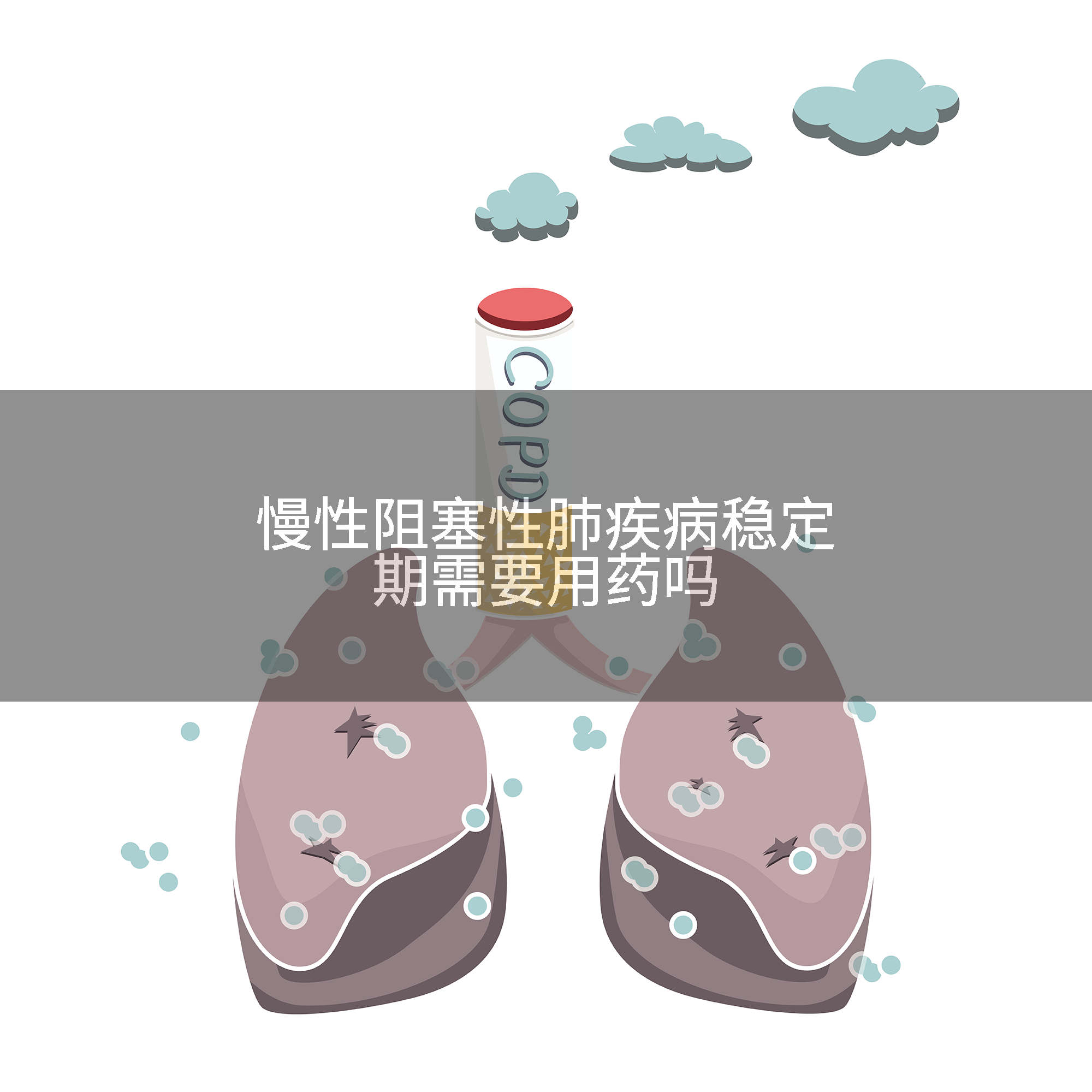 慢性阻塞性肺疾病稳定期需要用药吗