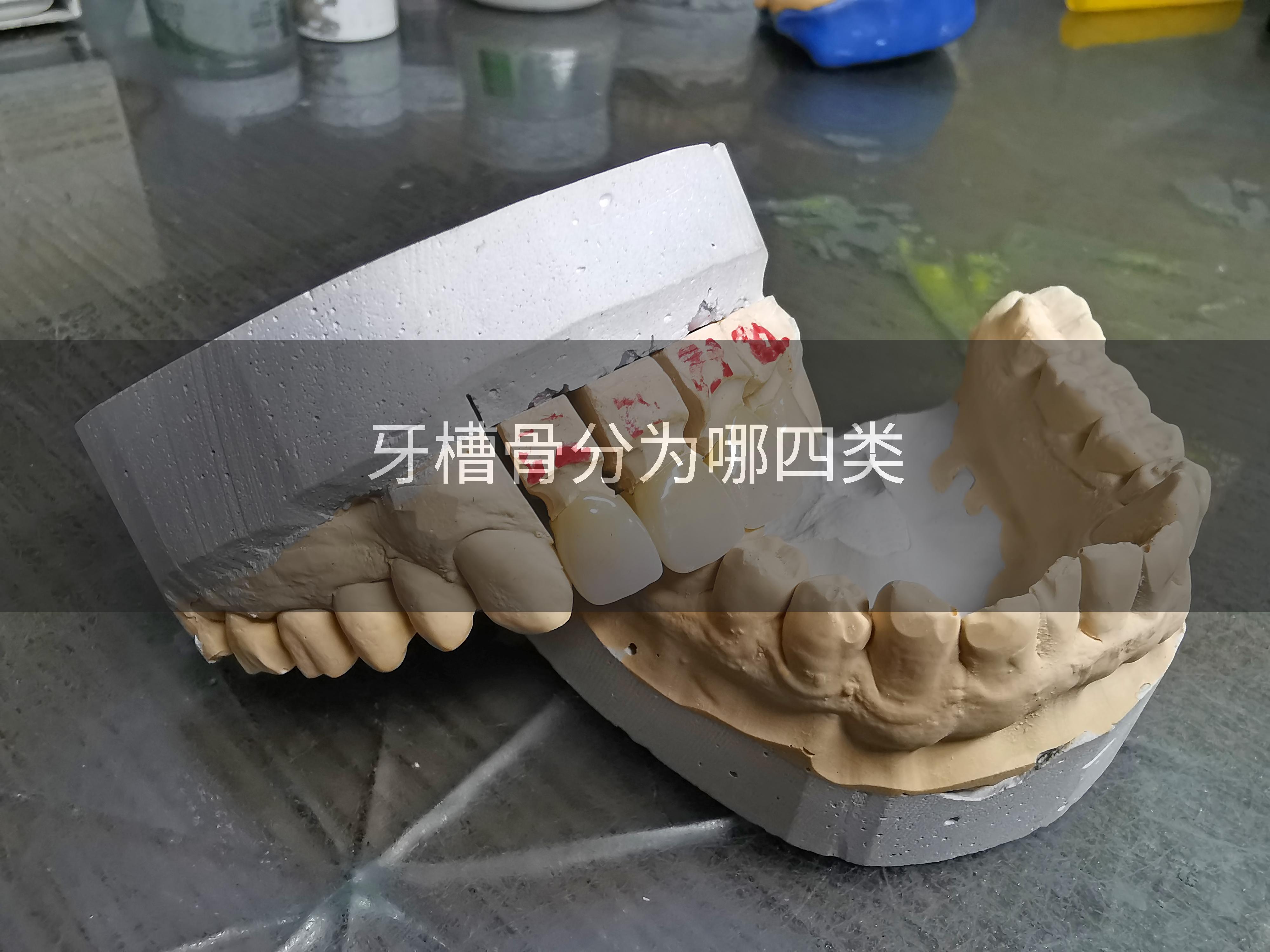 牙槽骨分为哪四类
