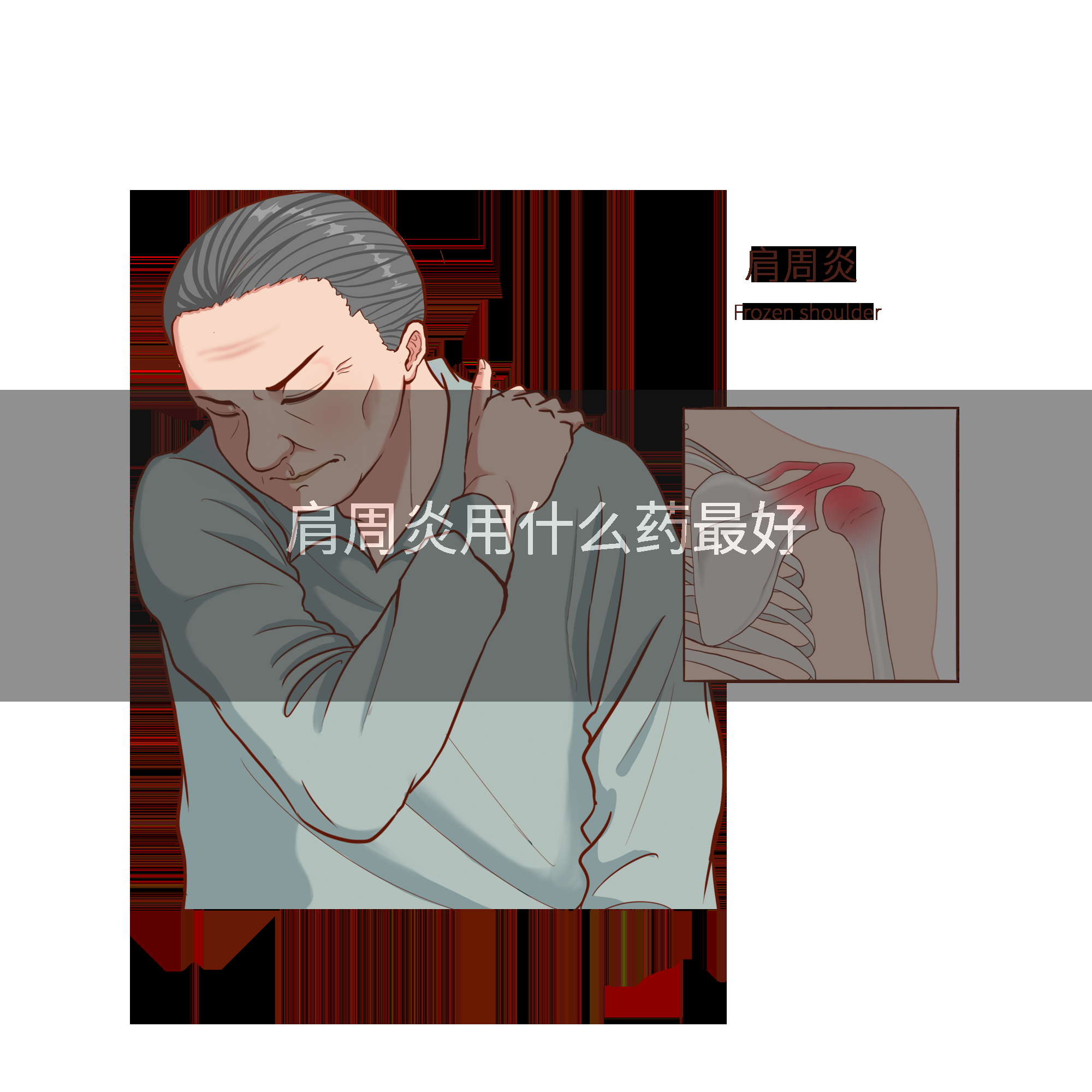 肩周炎用什么药最好