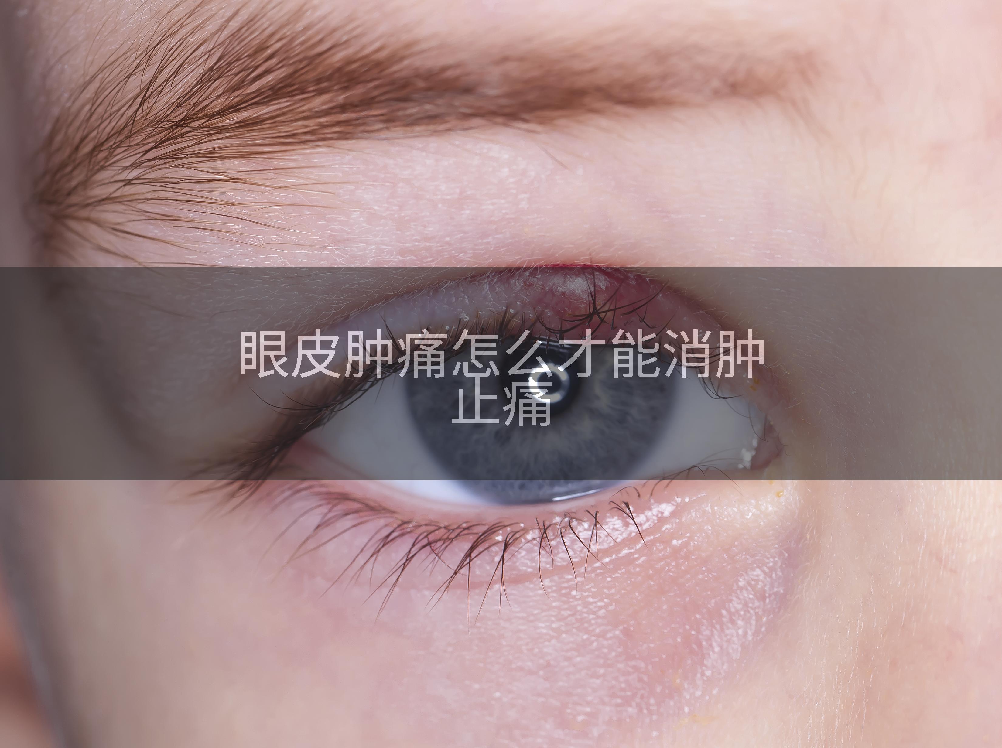 眼皮肿痛怎么才能消肿止痛