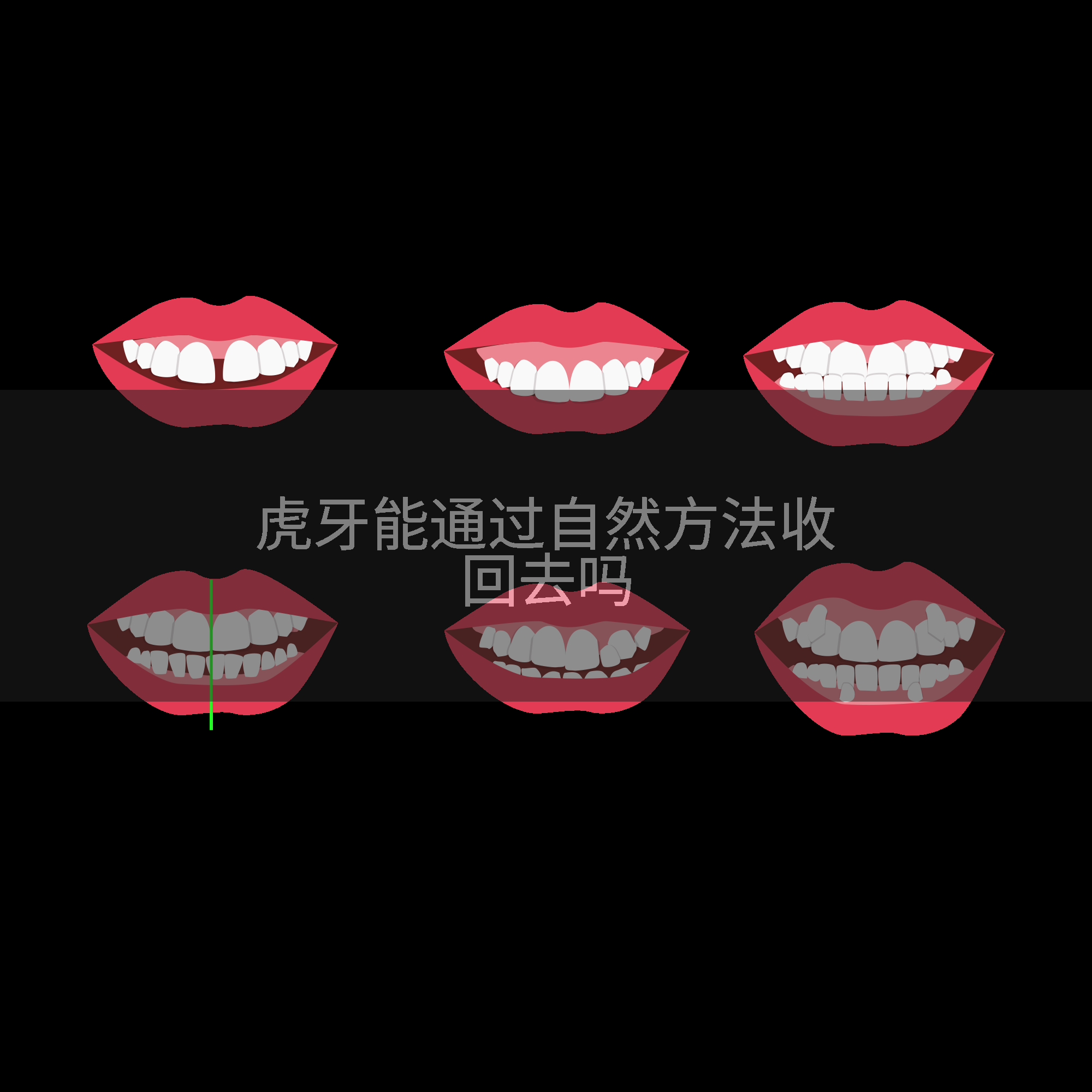 虎牙能通过自然方法收回去吗