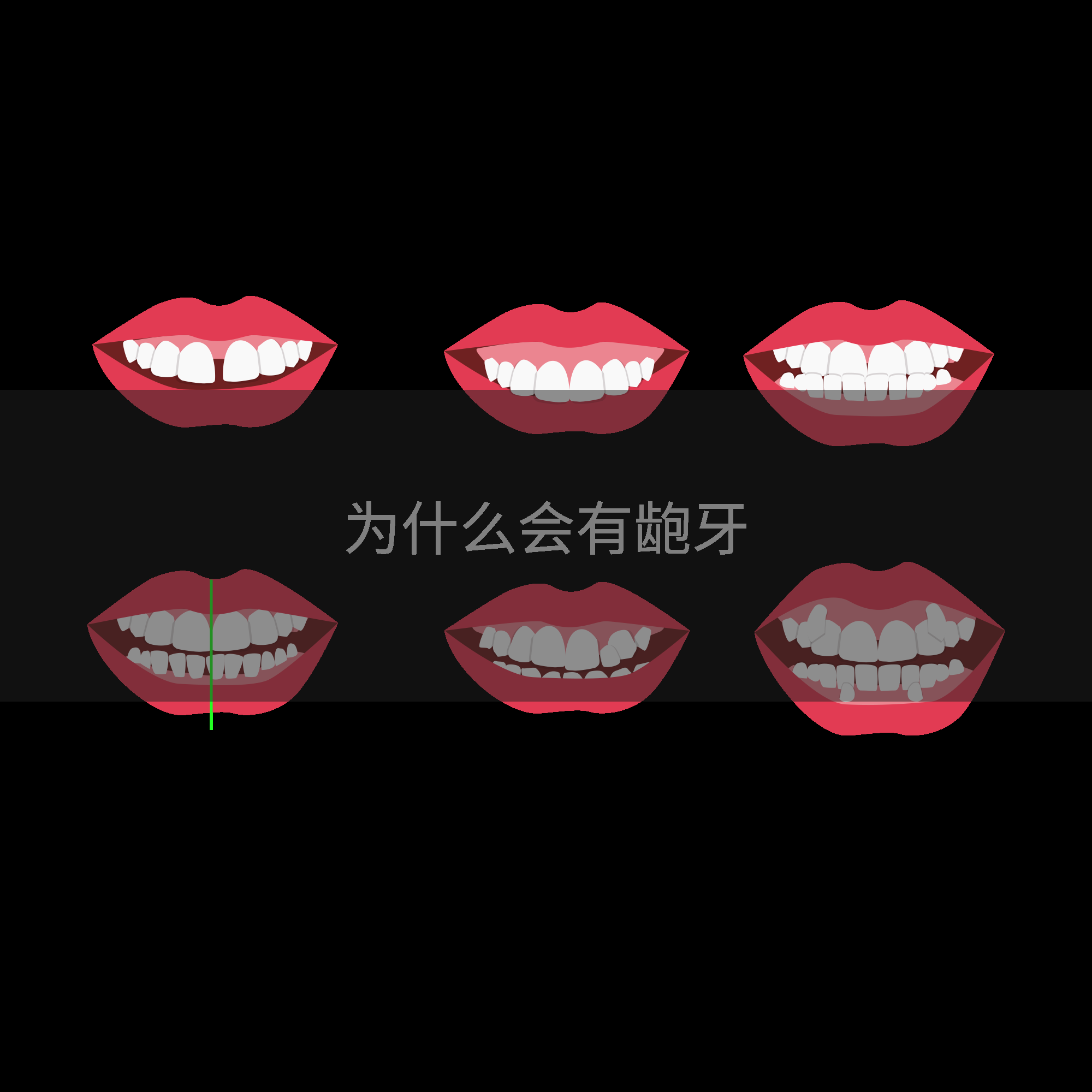 为什么会有龅牙