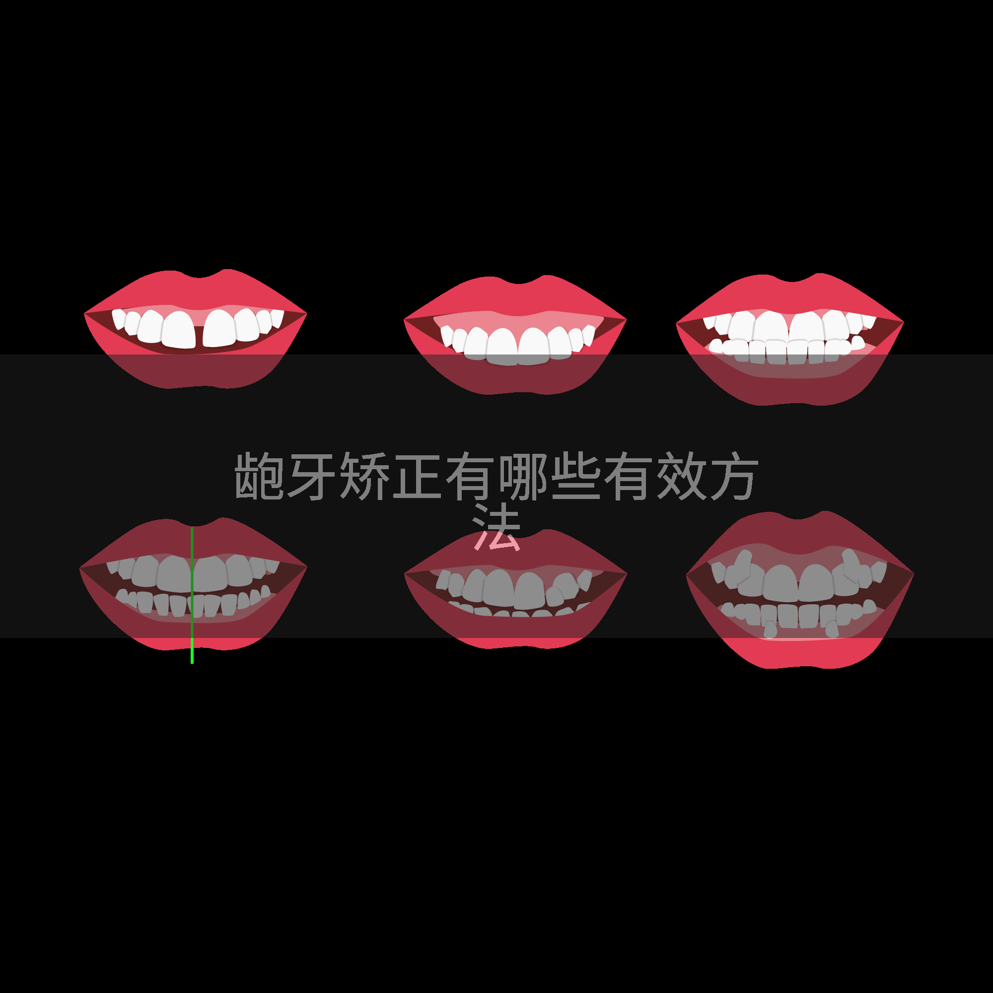 龅牙矫正有哪些有效方法