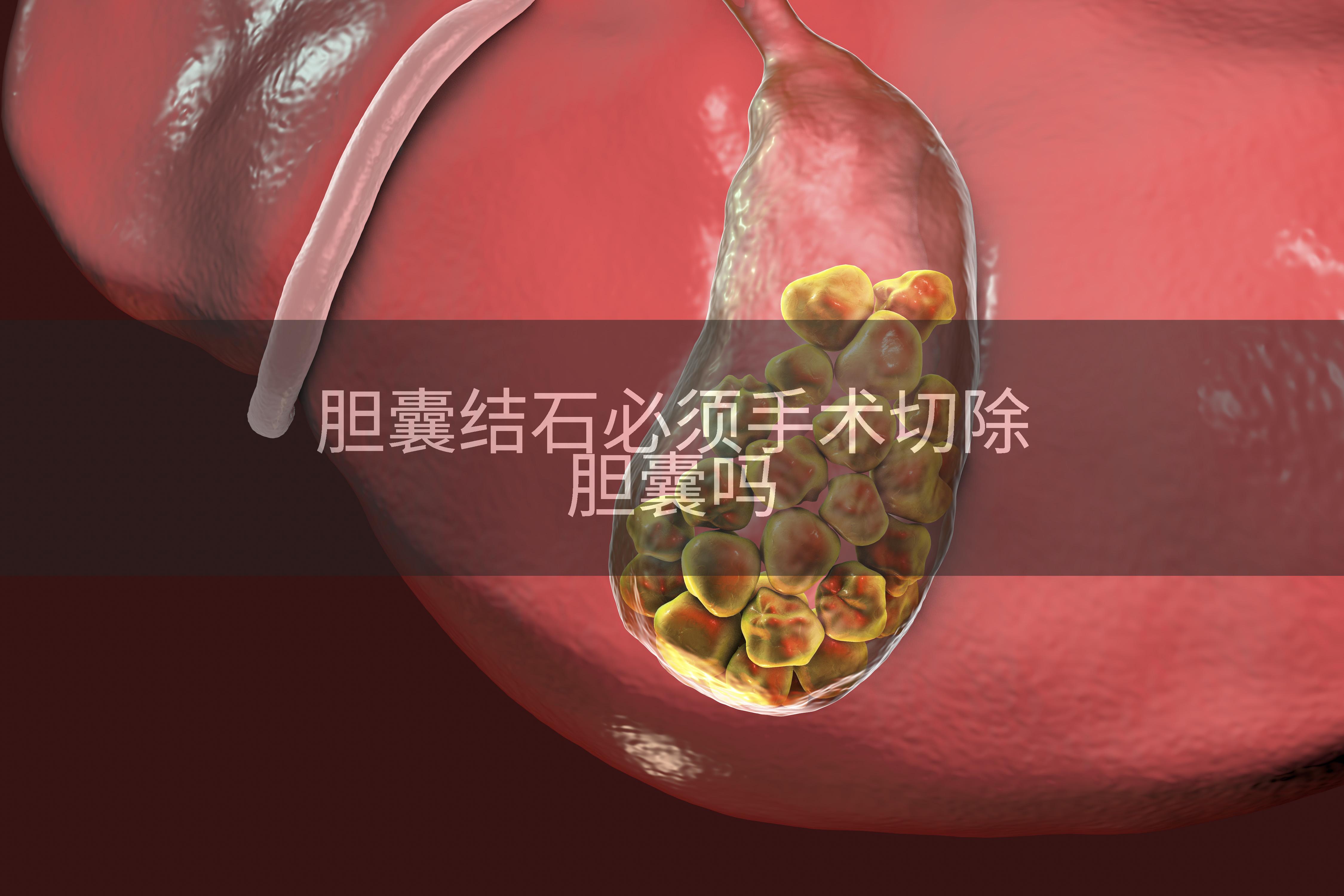 胆囊结石必须手术切除胆囊吗