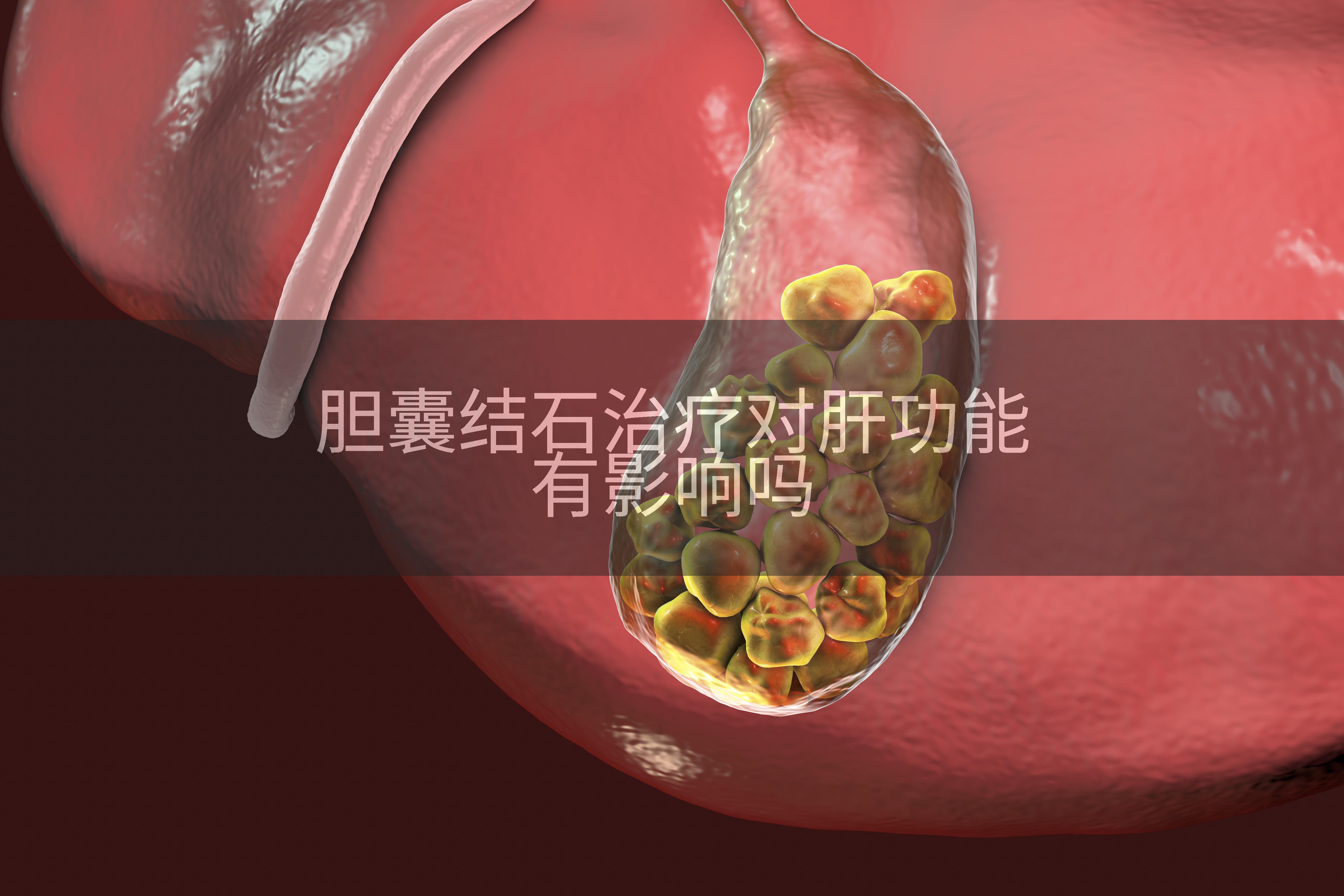 胆囊结石治疗对肝功能有影响吗
