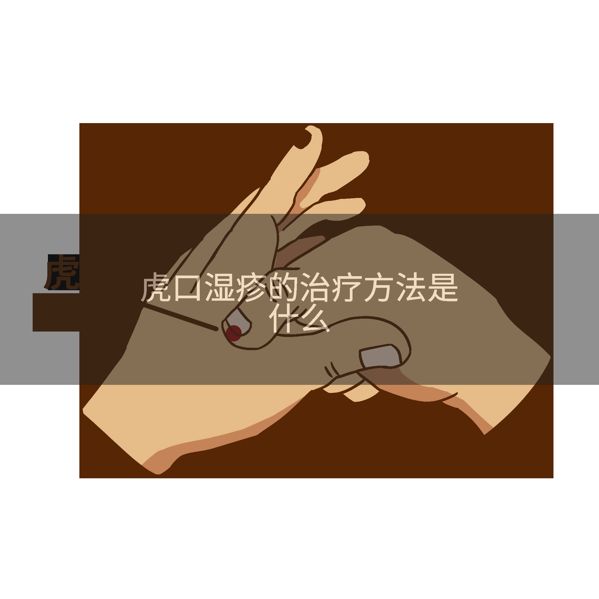 虎口湿疹的治疗方法是什么