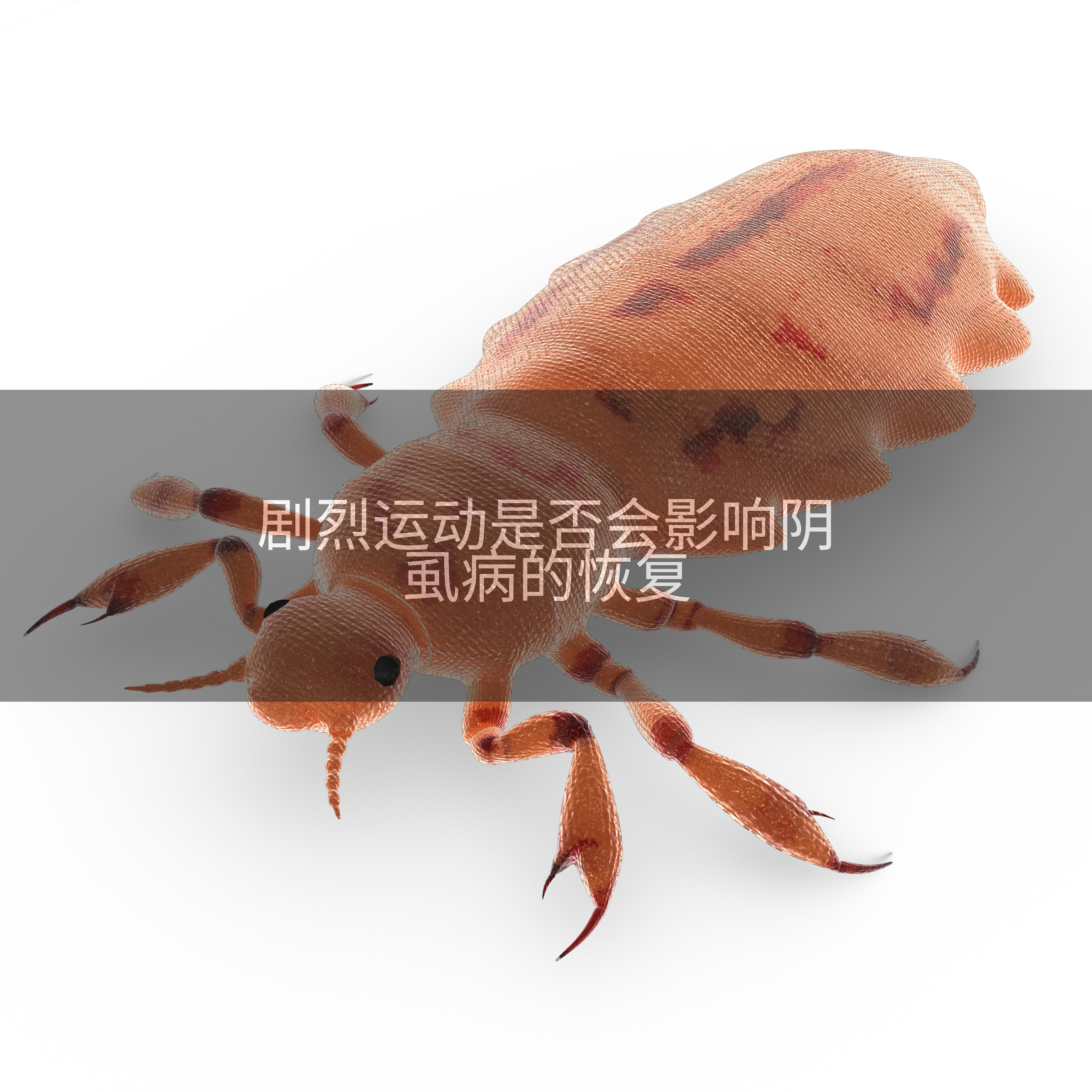 剧烈运动是否会影响阴虱病的恢复