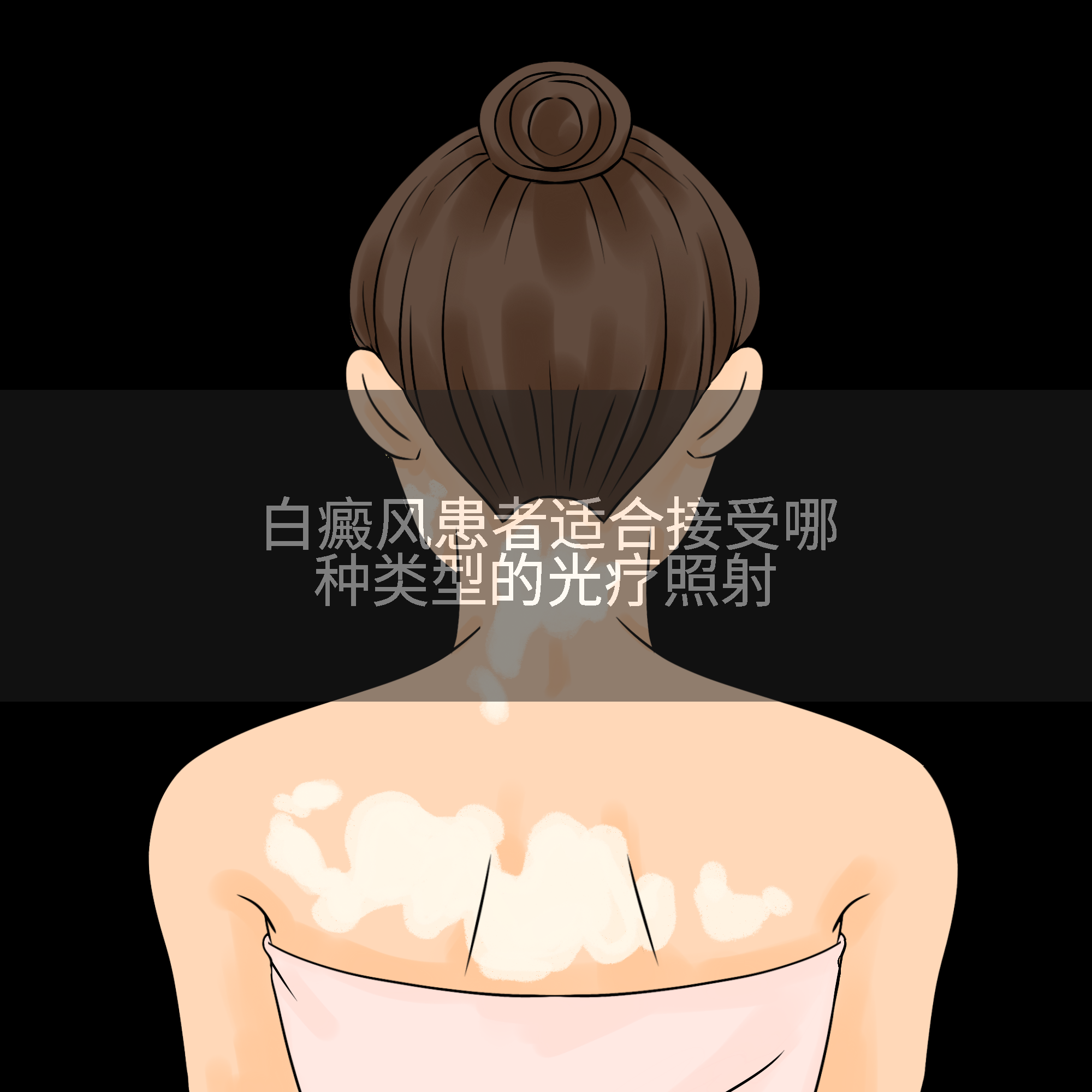 白癜风患者适合接受哪种类型的光疗照射