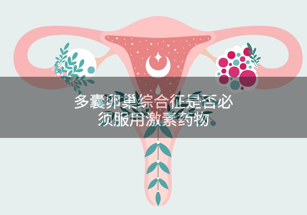 多囊卵巢综合征是否必须服用激素药物