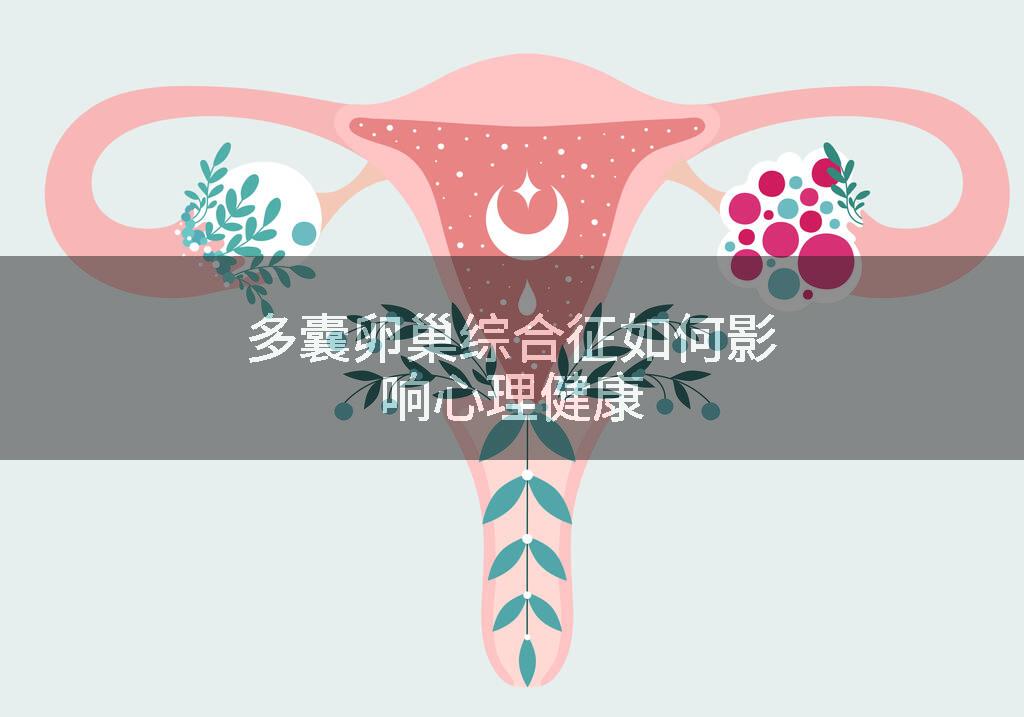 多囊卵巢综合征如何影响心理健康