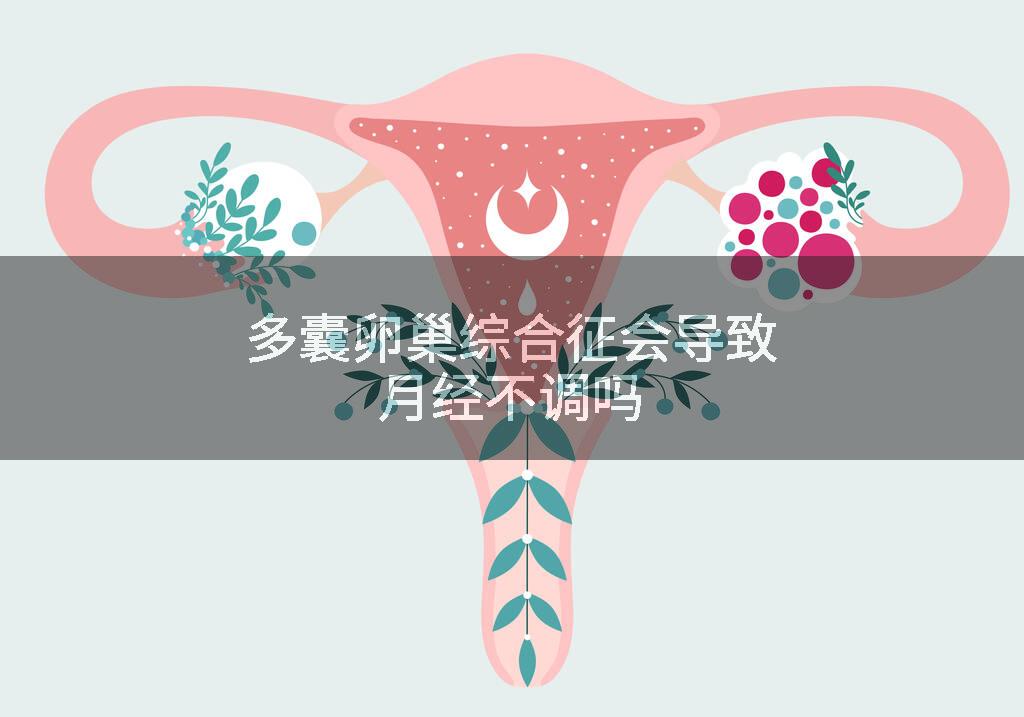 多囊卵巢综合征会导致月经不调吗