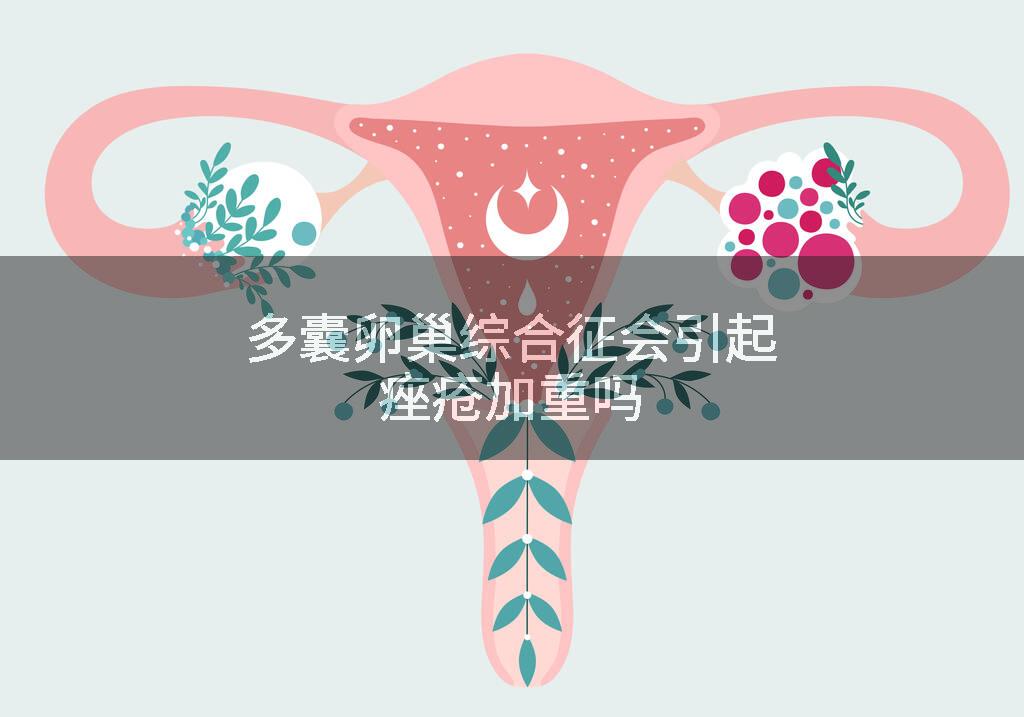 多囊卵巢综合征会引起痤疮加重吗