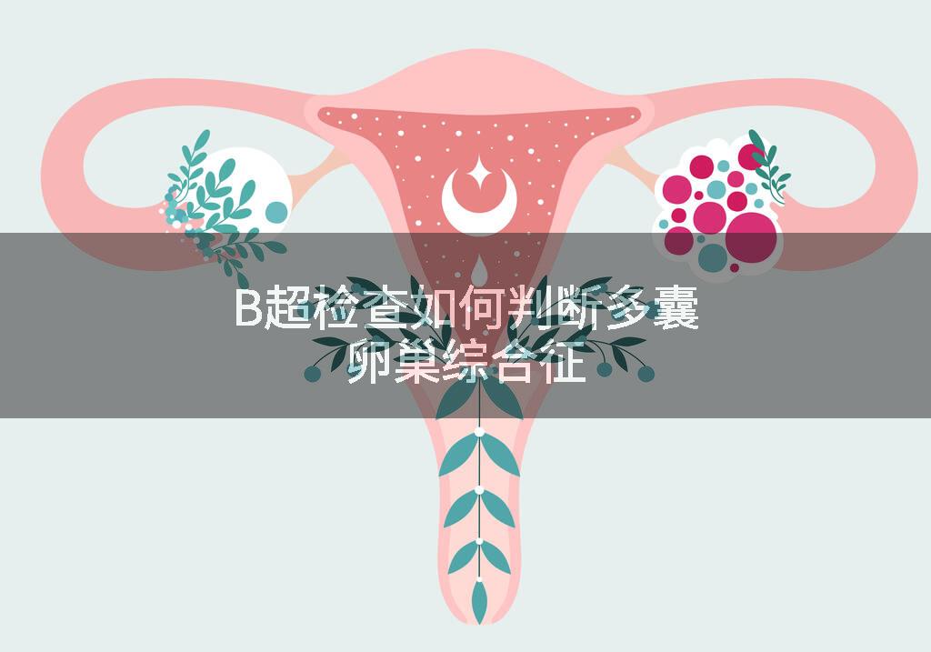 B超检查如何判断多囊卵巢综合征