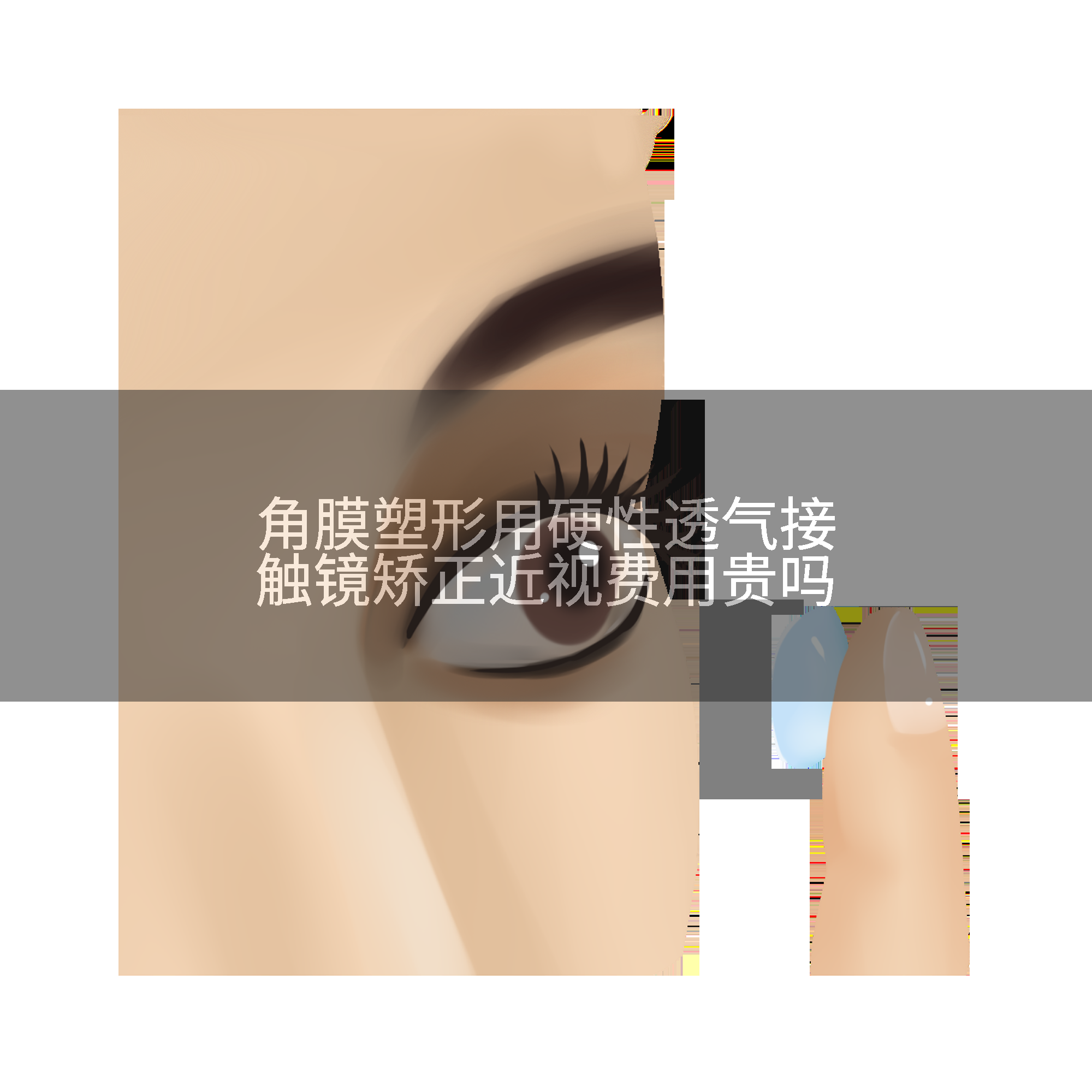 角膜塑形用硬性透气接触镜矫正近视费用贵吗