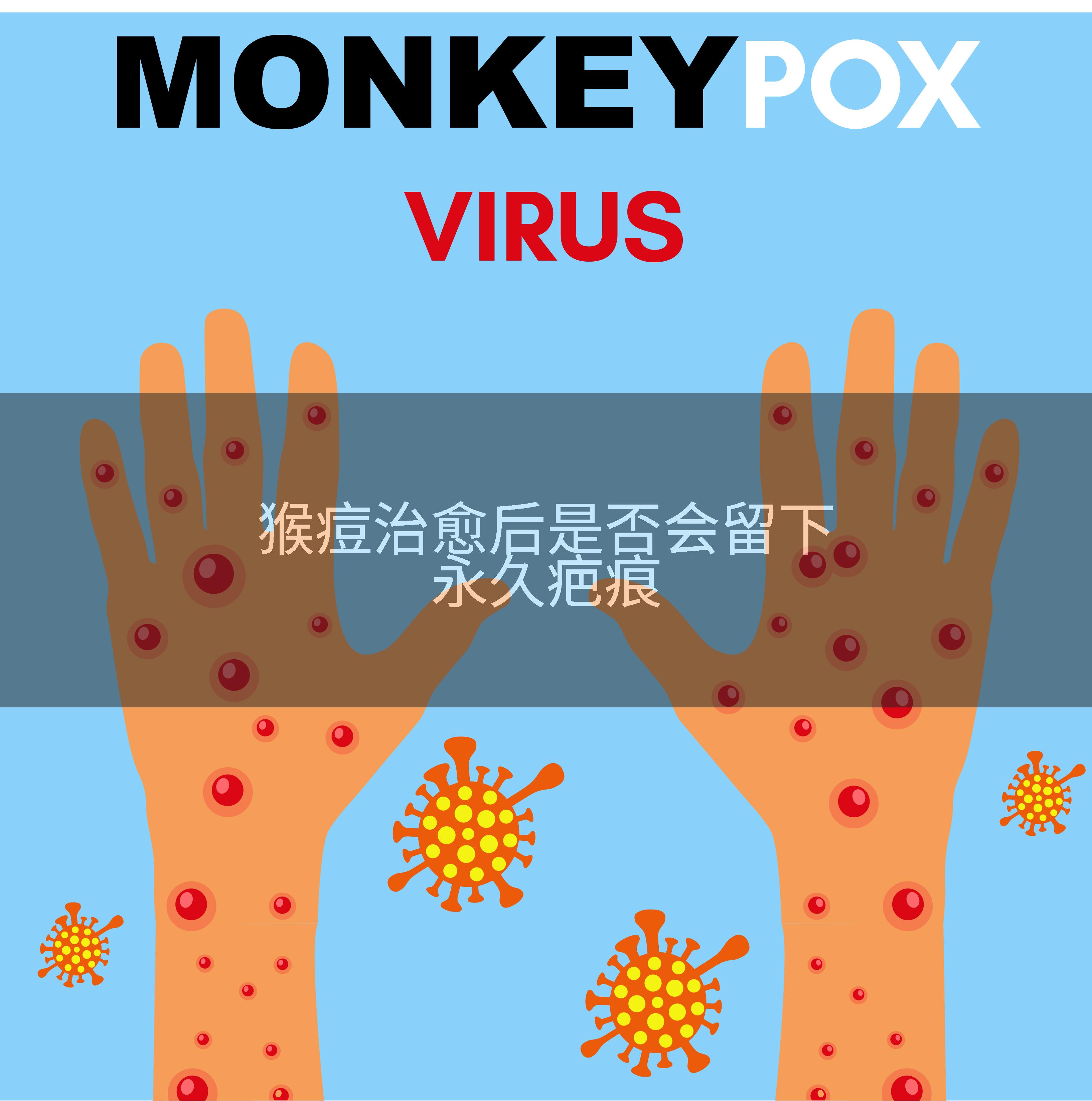 猴痘治愈后是否会留下永久疤痕