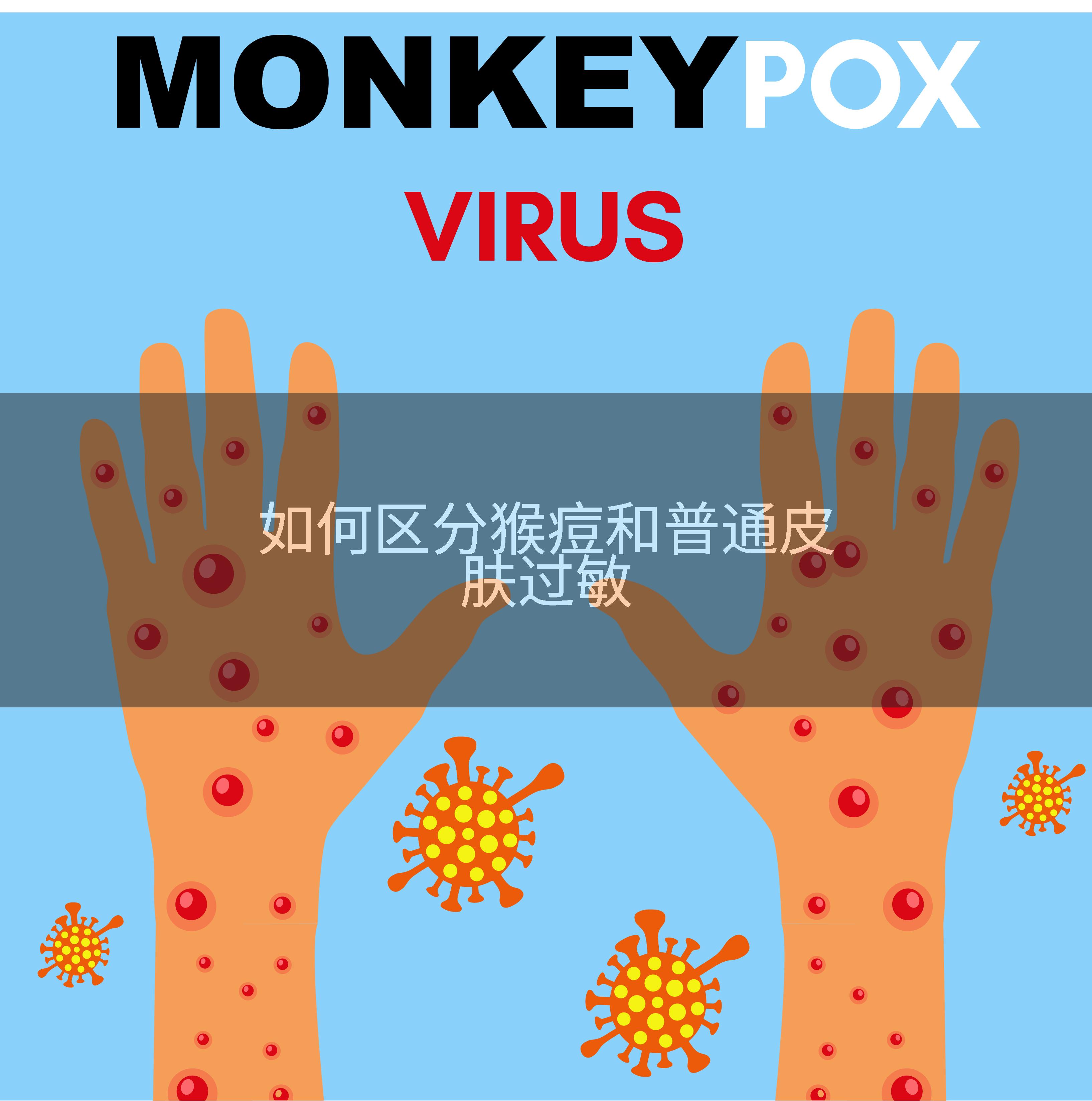 如何区分猴痘和普通皮肤过敏