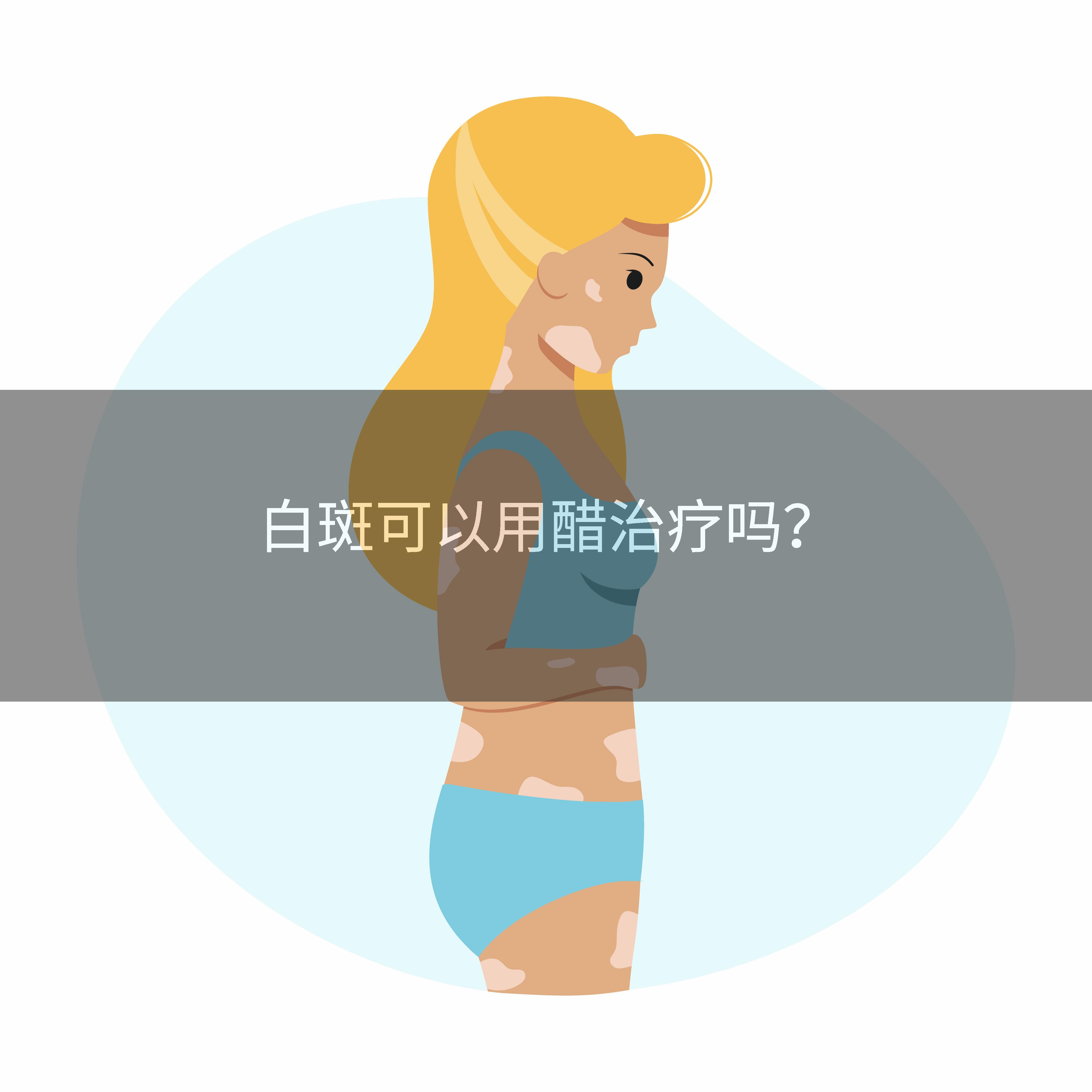 白斑可以用醋治疗吗？