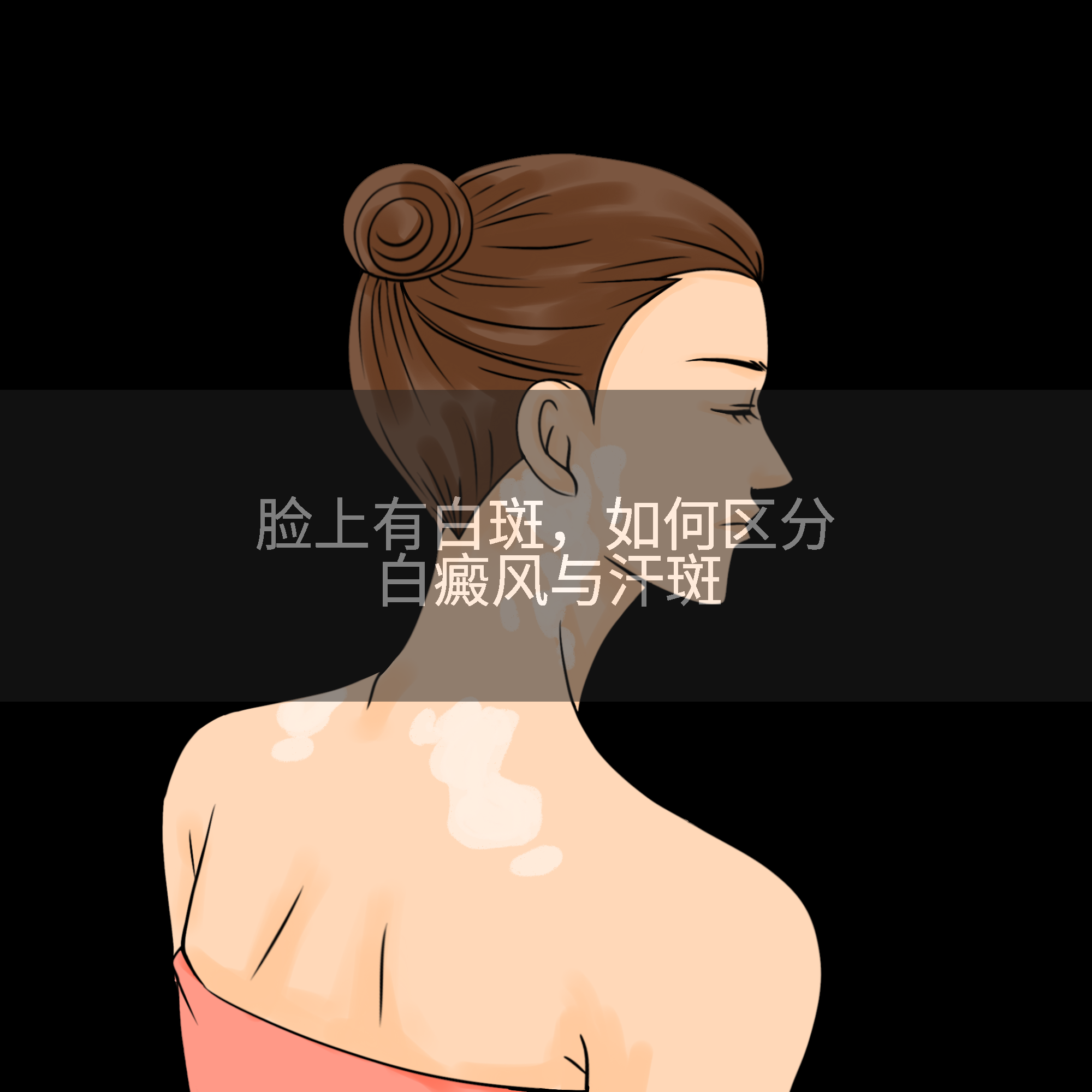 脸上有白斑，如何区分白癜风与汗斑