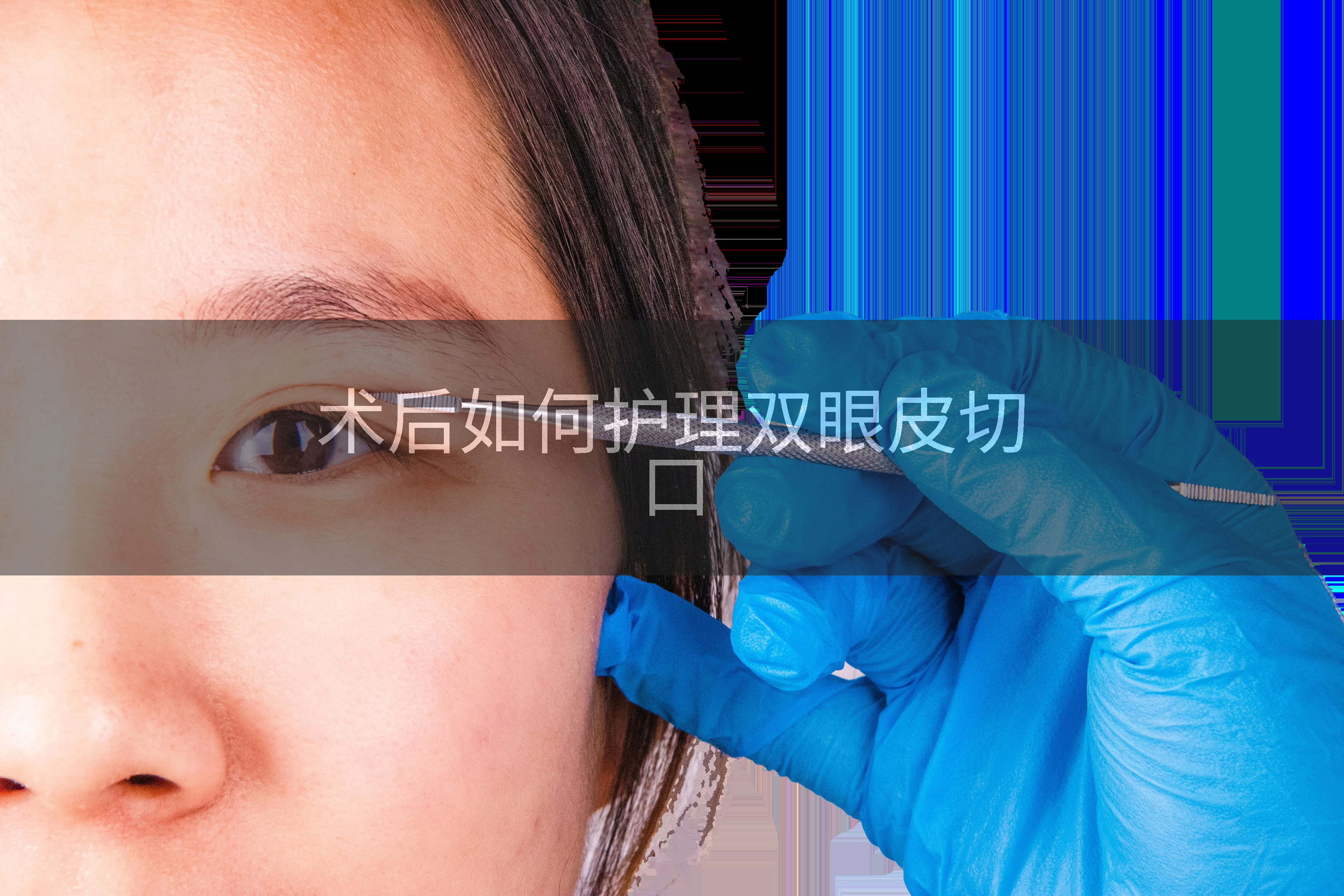 术后如何护理双眼皮切口
