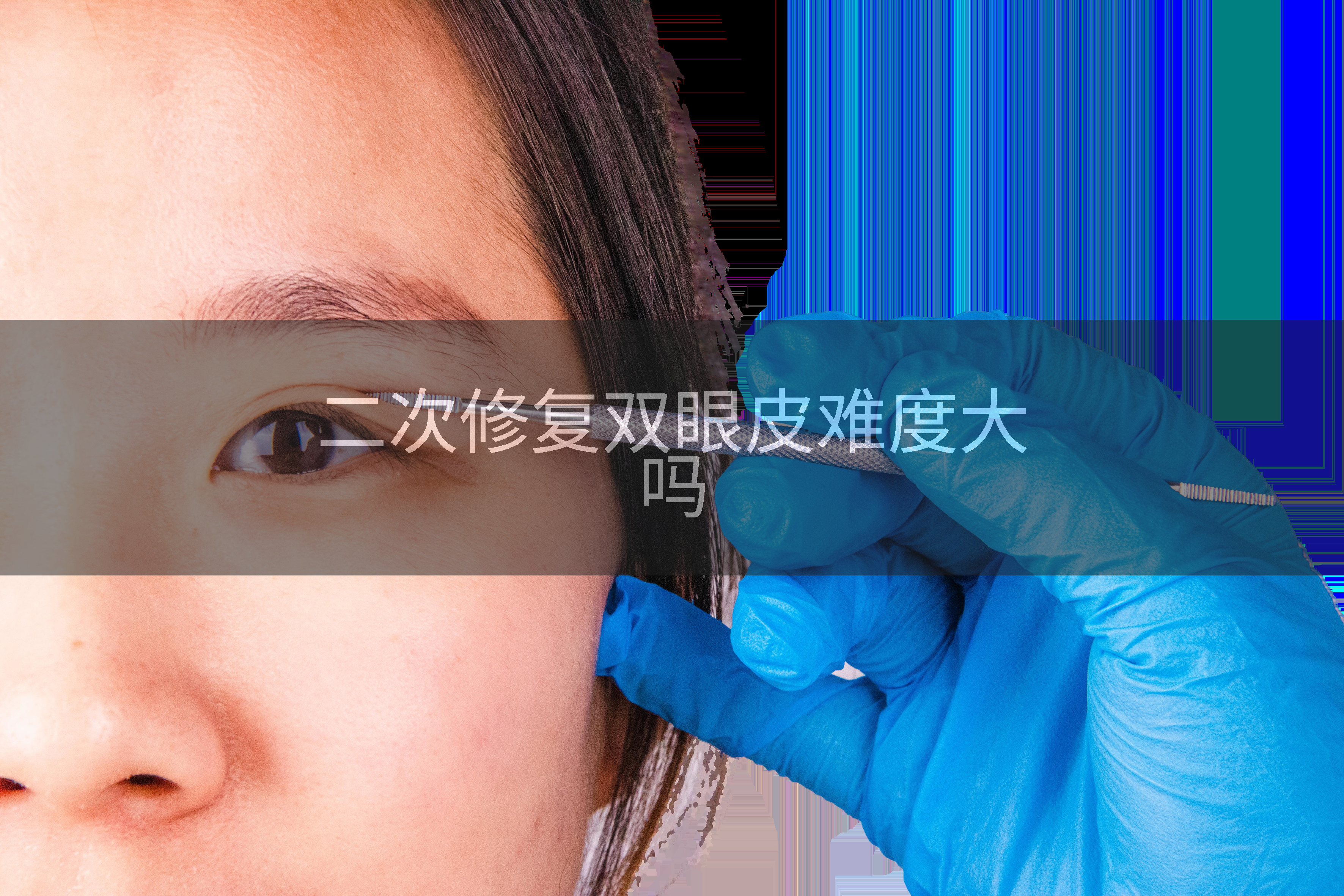 二次修复双眼皮难度大吗