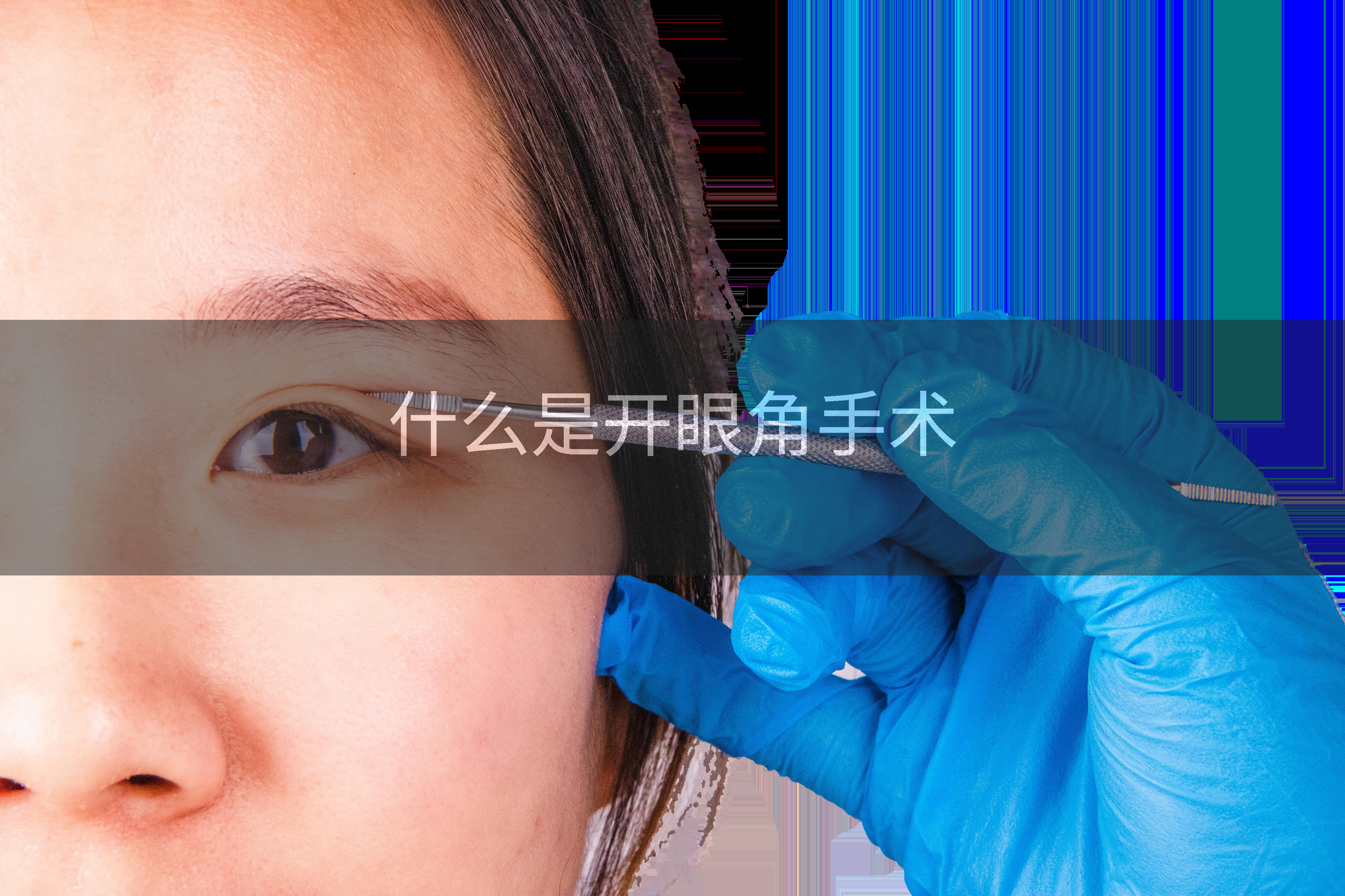 什么是开眼角手术