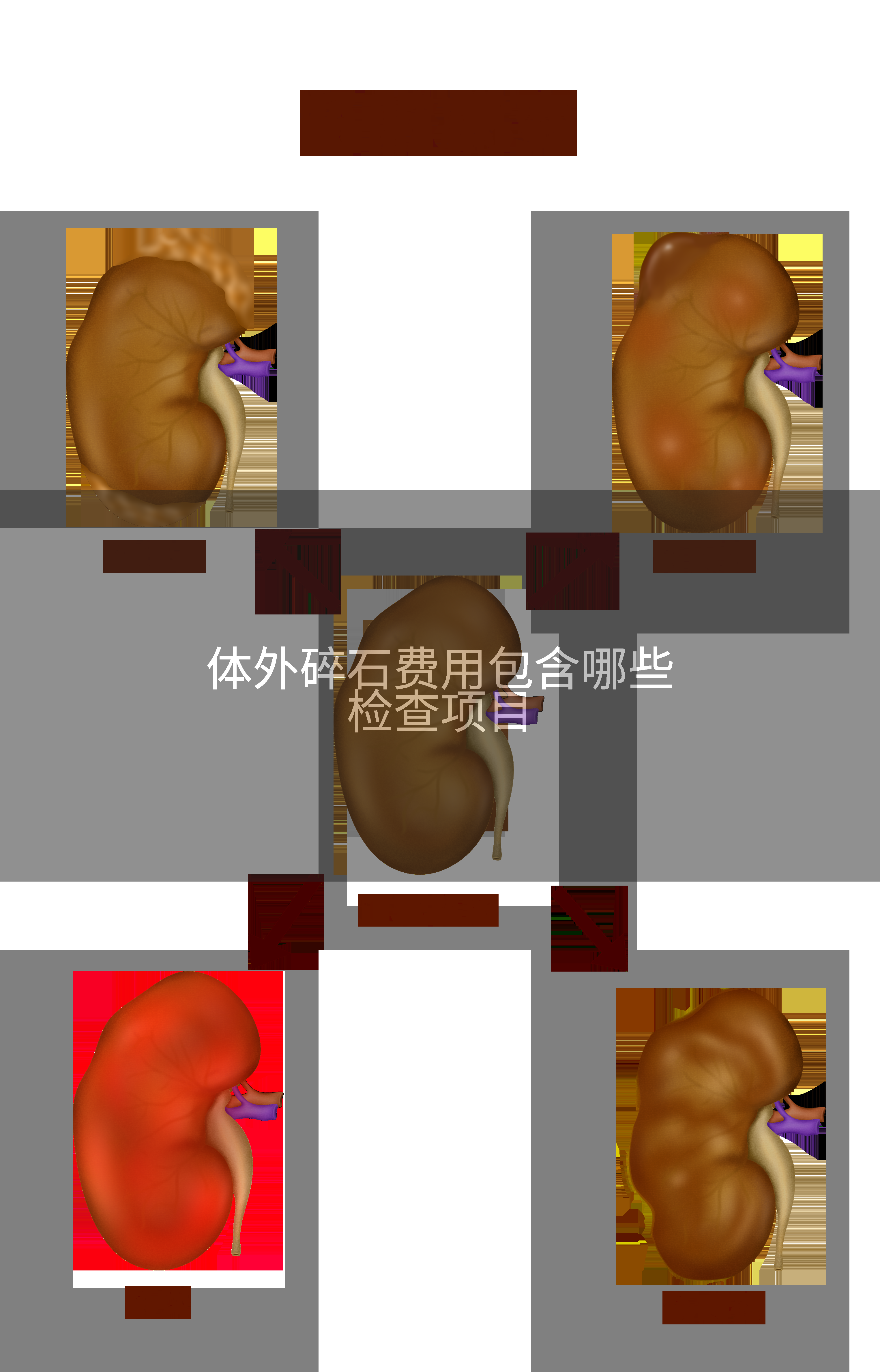 体外碎石费用包含哪些检查项目