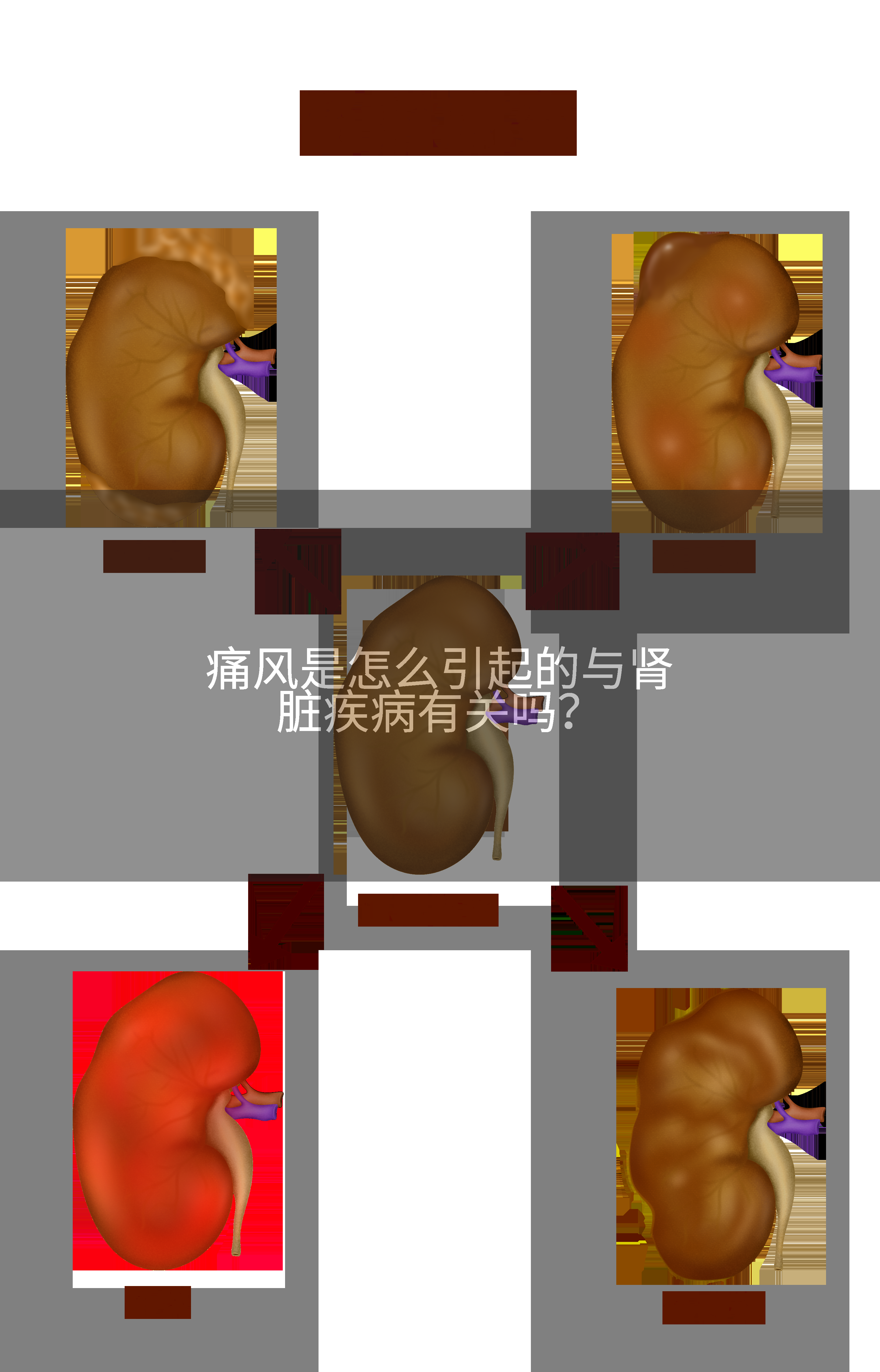 痛风是怎么引起的与肾脏疾病有关吗？