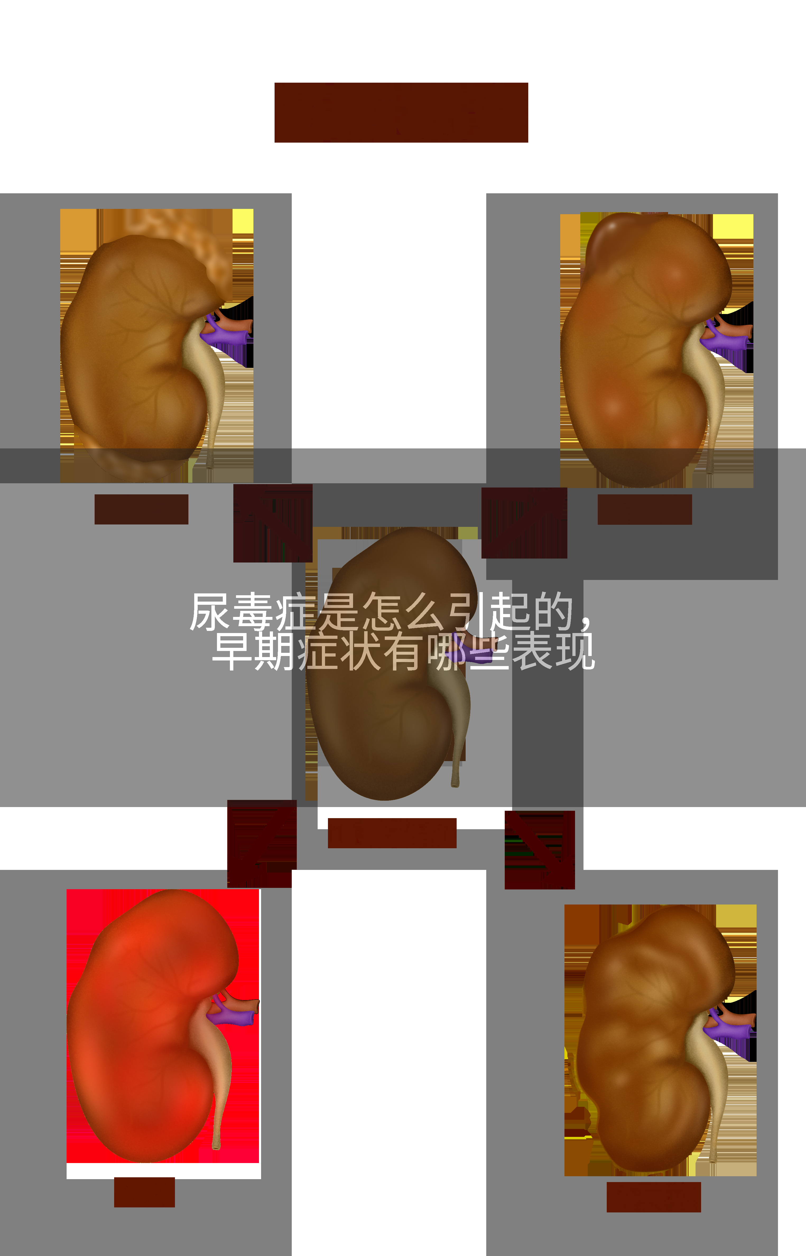 尿毒症是怎么引起的，早期症状有哪些表现