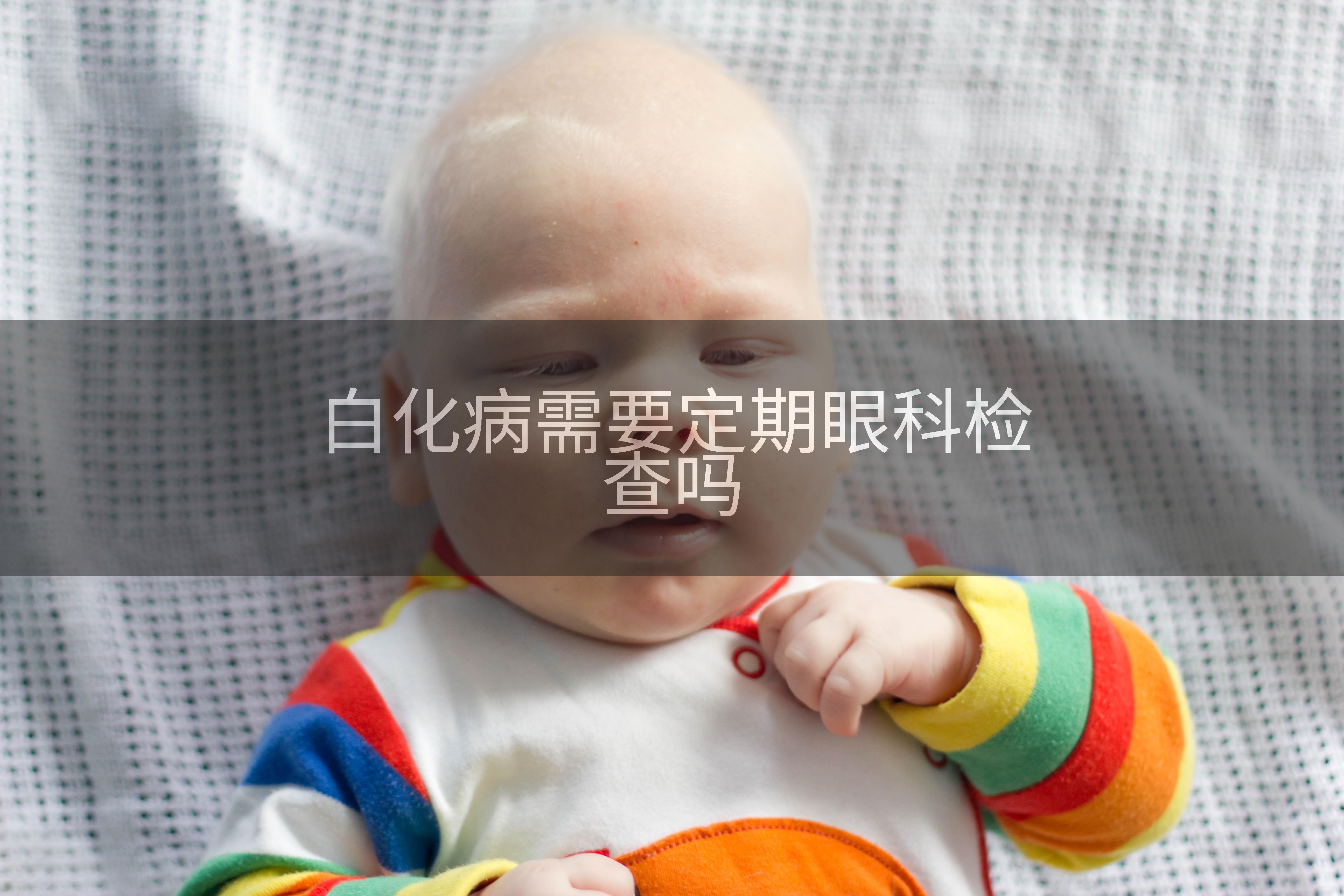 白化病需要定期眼科检查吗