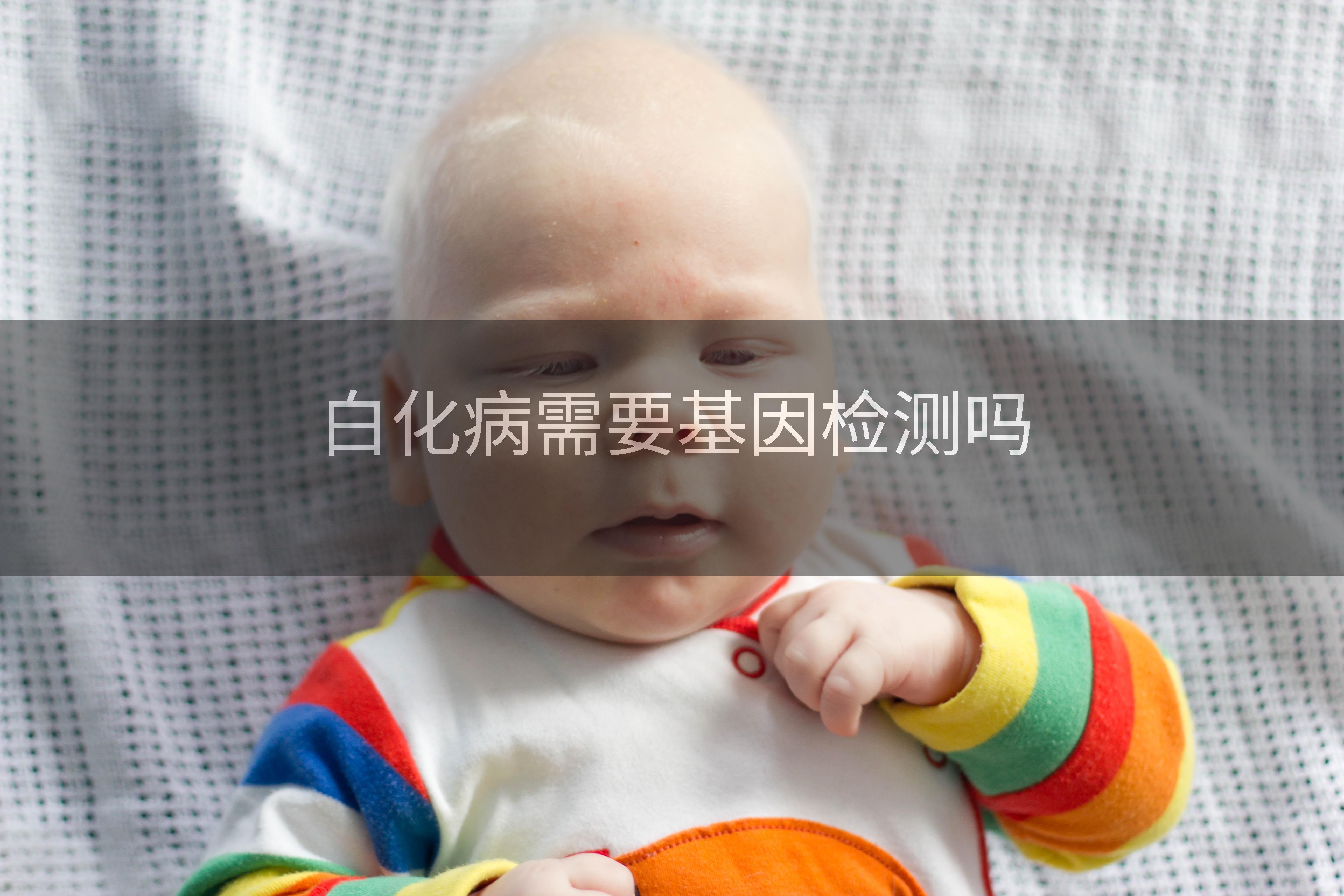 白化病需要基因检测吗