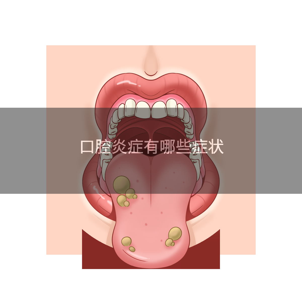 口腔炎症有哪些症状