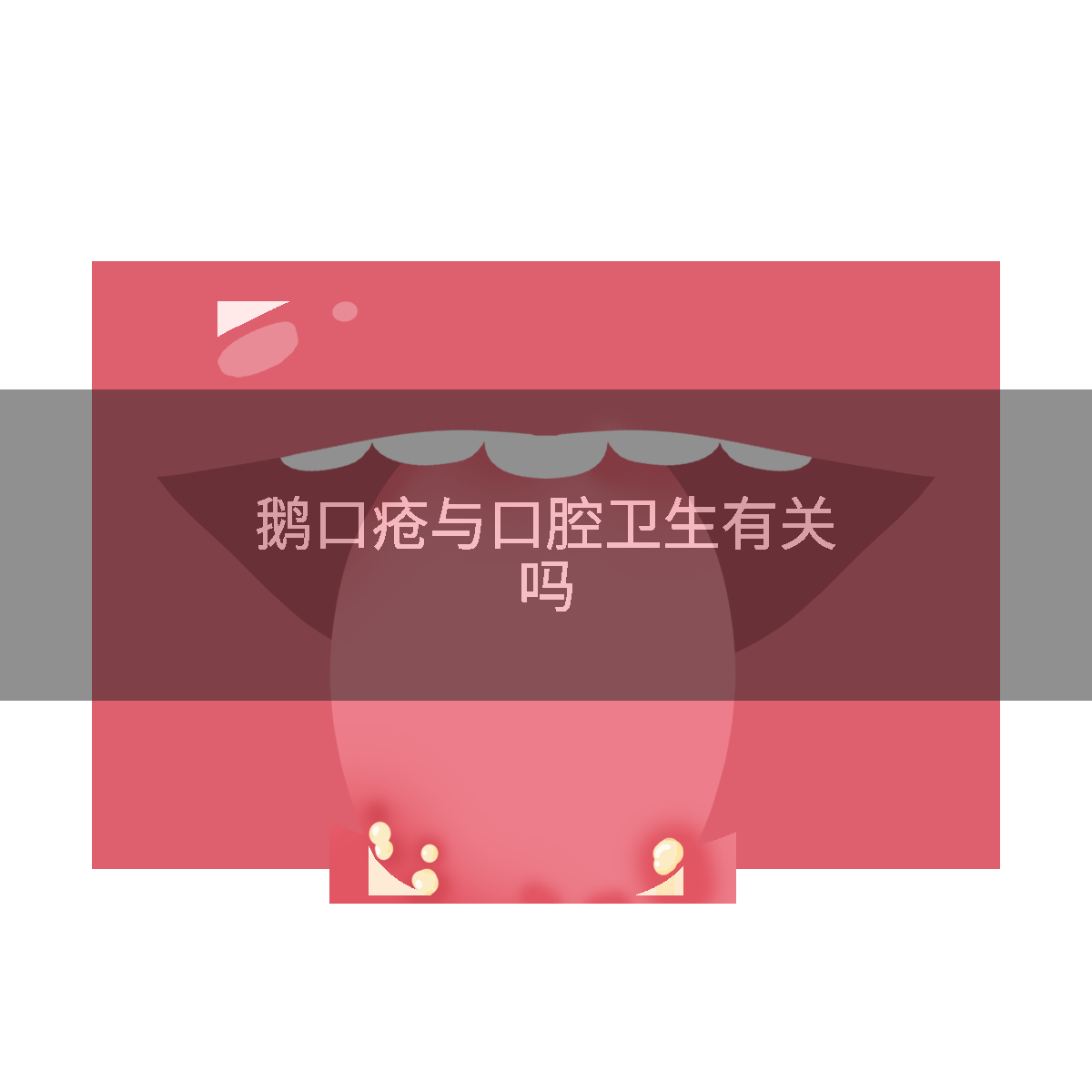 鹅口疮与口腔卫生有关吗