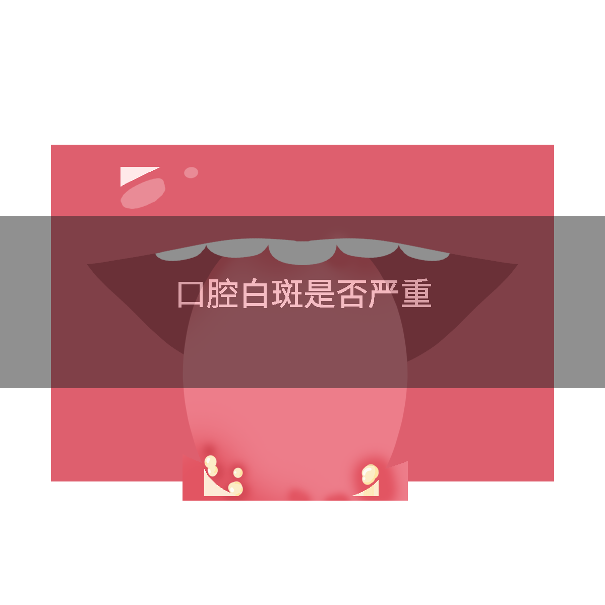 口腔白斑是否严重