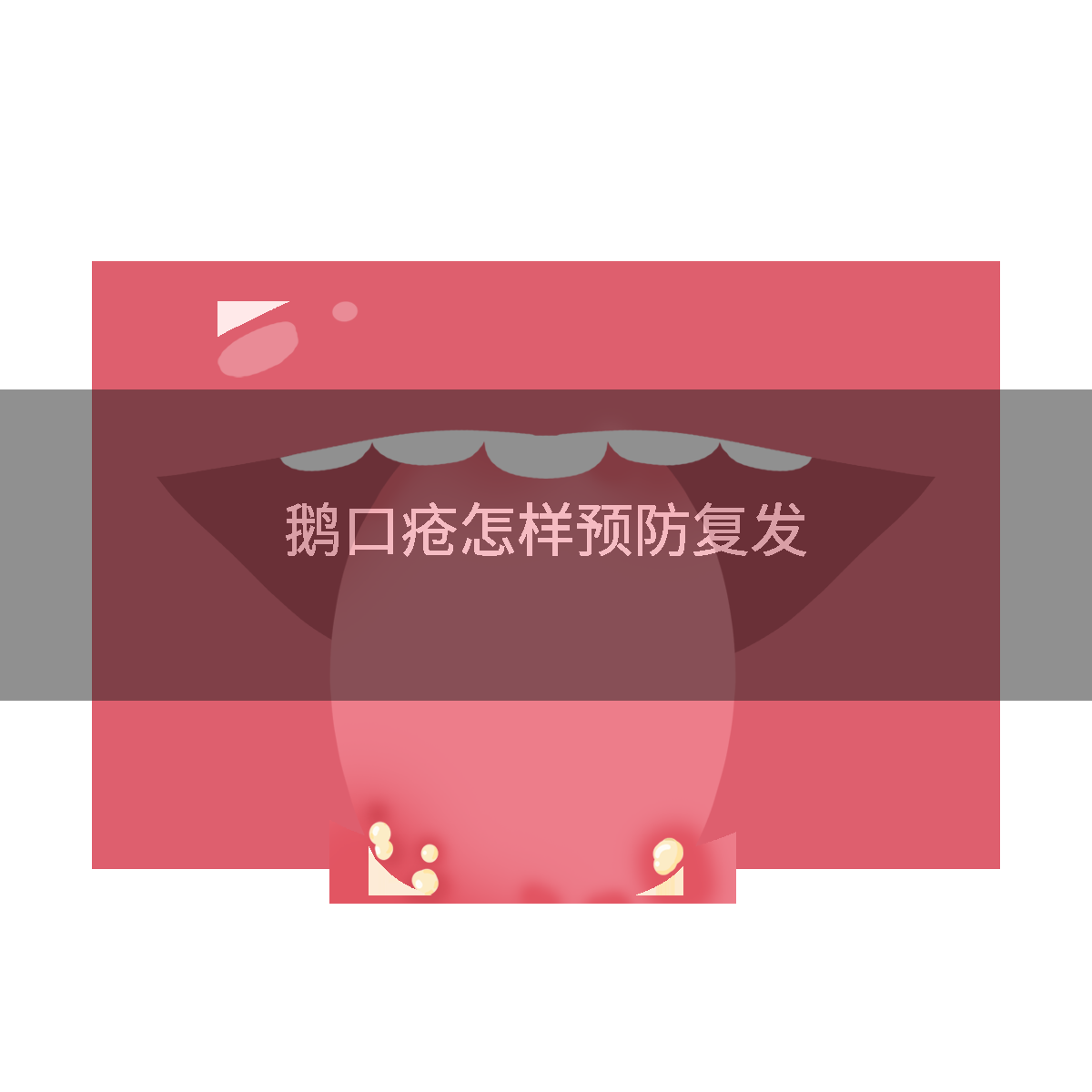 鹅口疮怎样预防复发