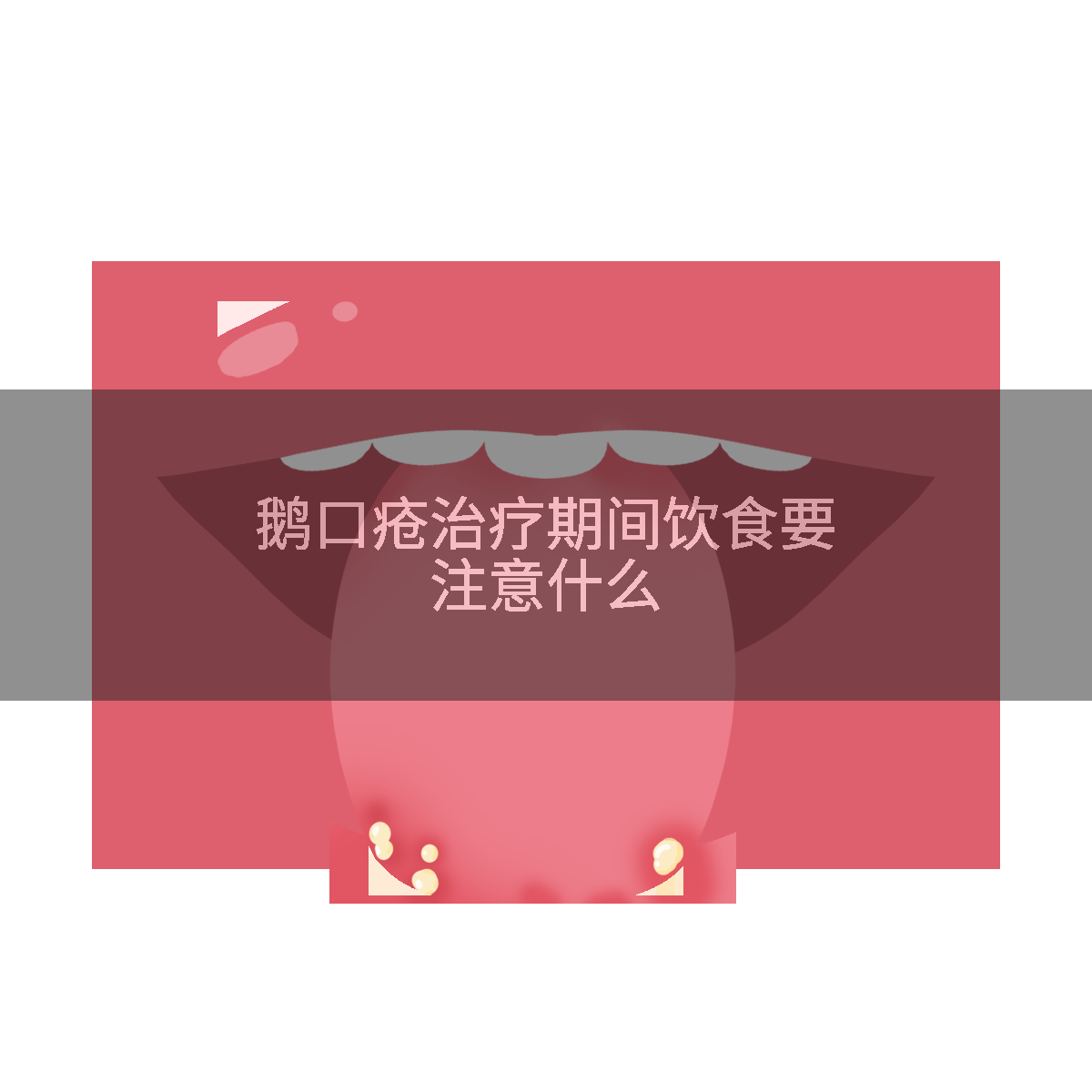 鹅口疮治疗期间饮食要注意什么