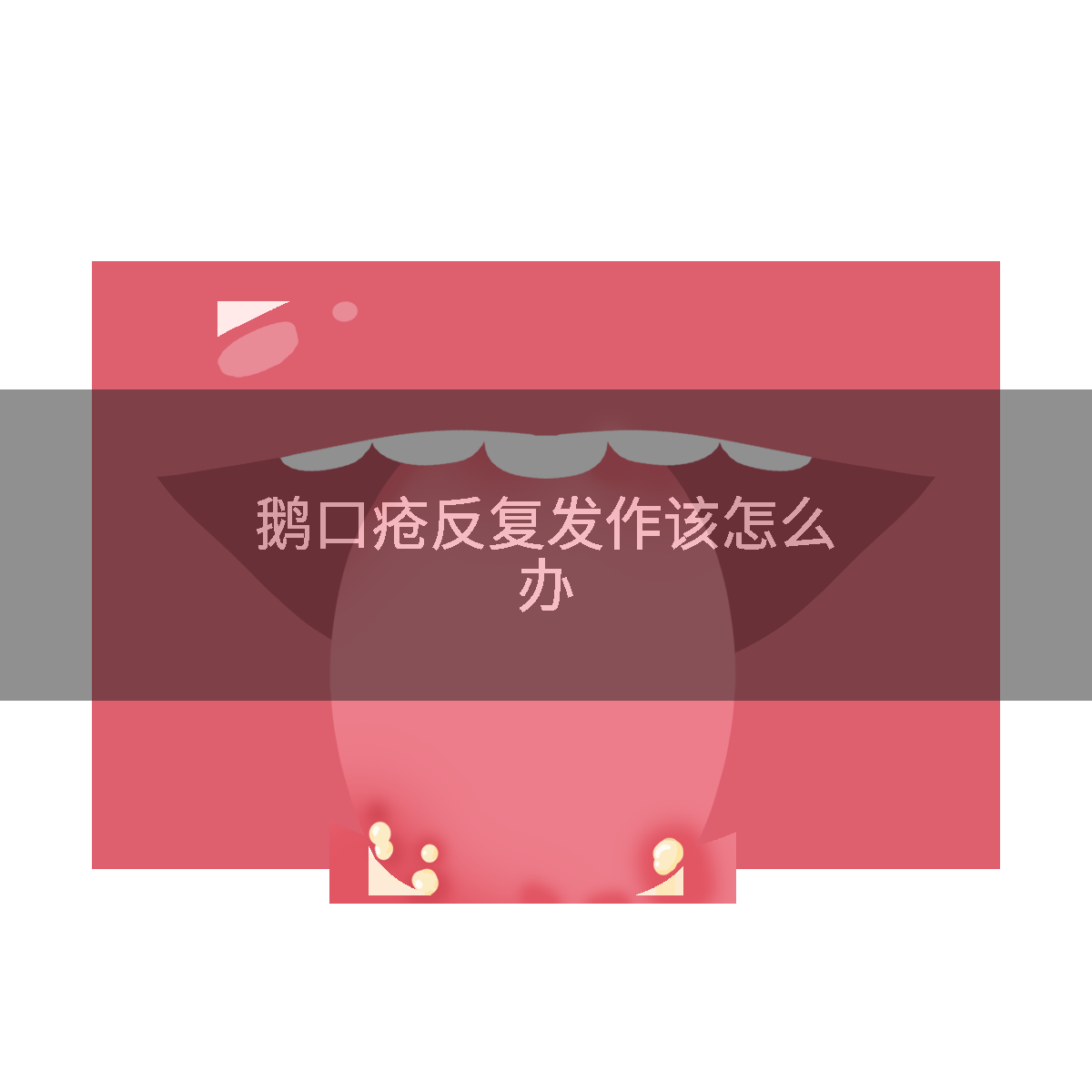 鹅口疮反复发作该怎么办