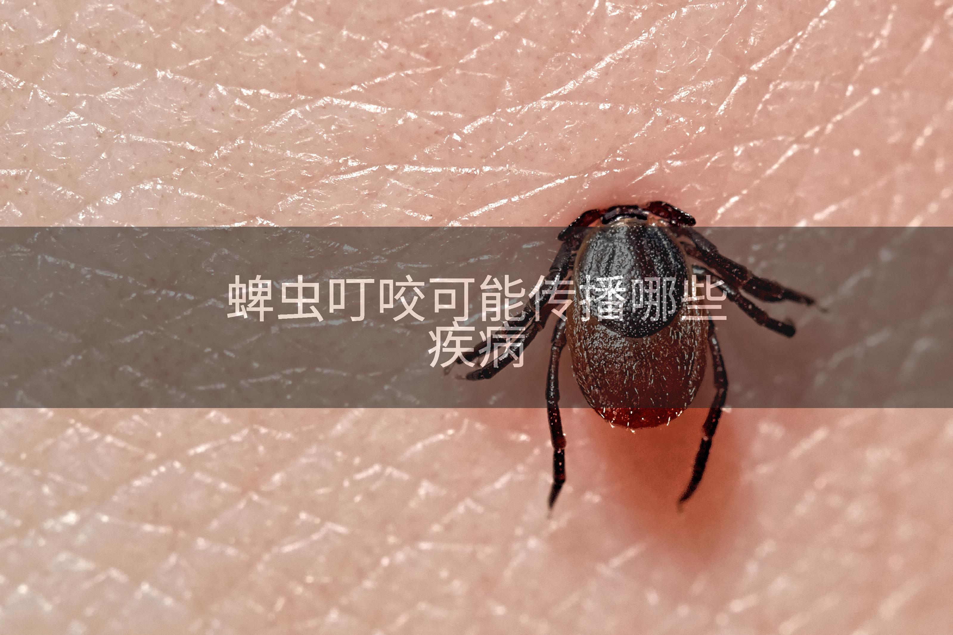 蜱虫叮咬可能传播哪些疾病