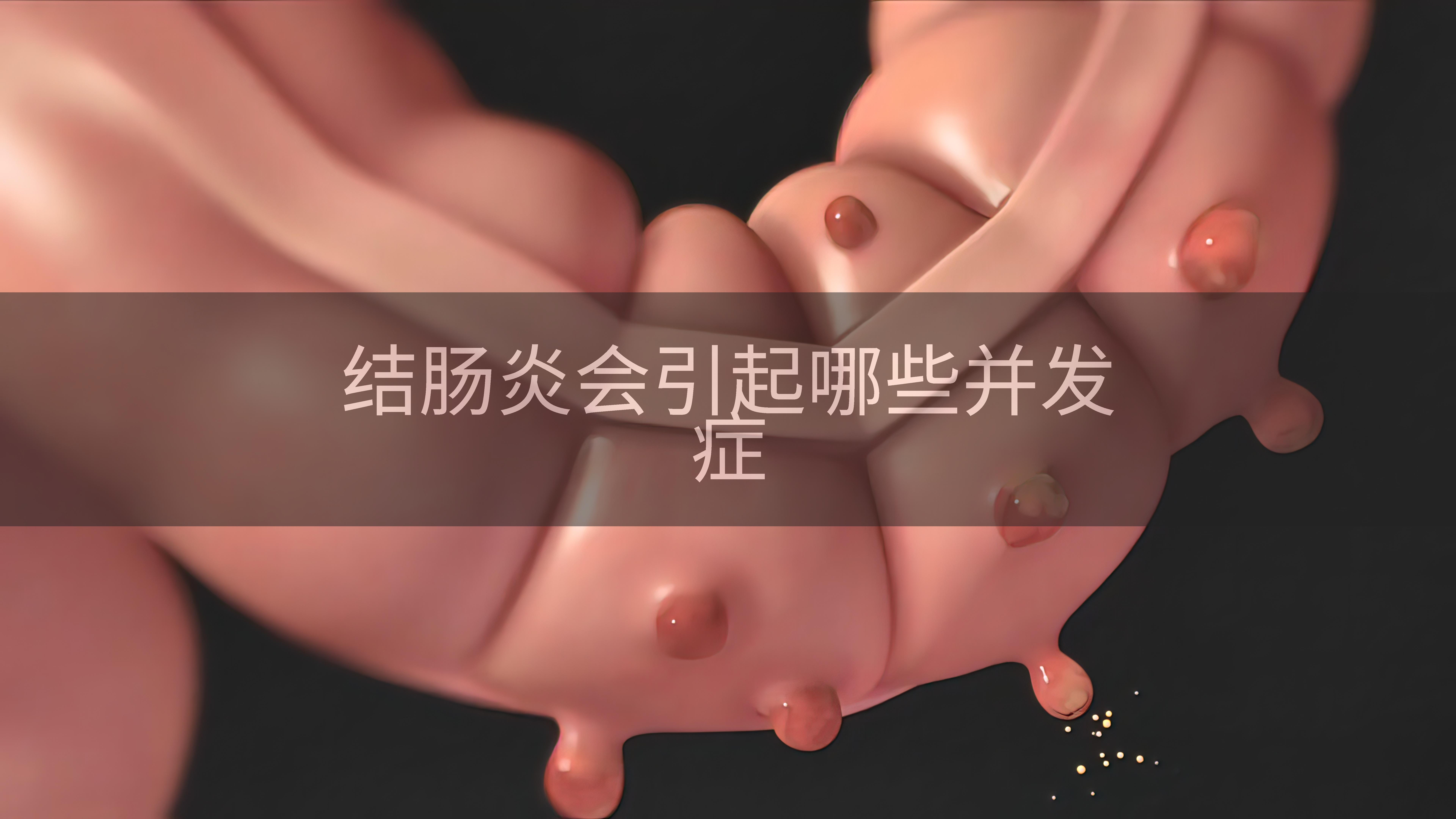 结肠炎会引起哪些并发症