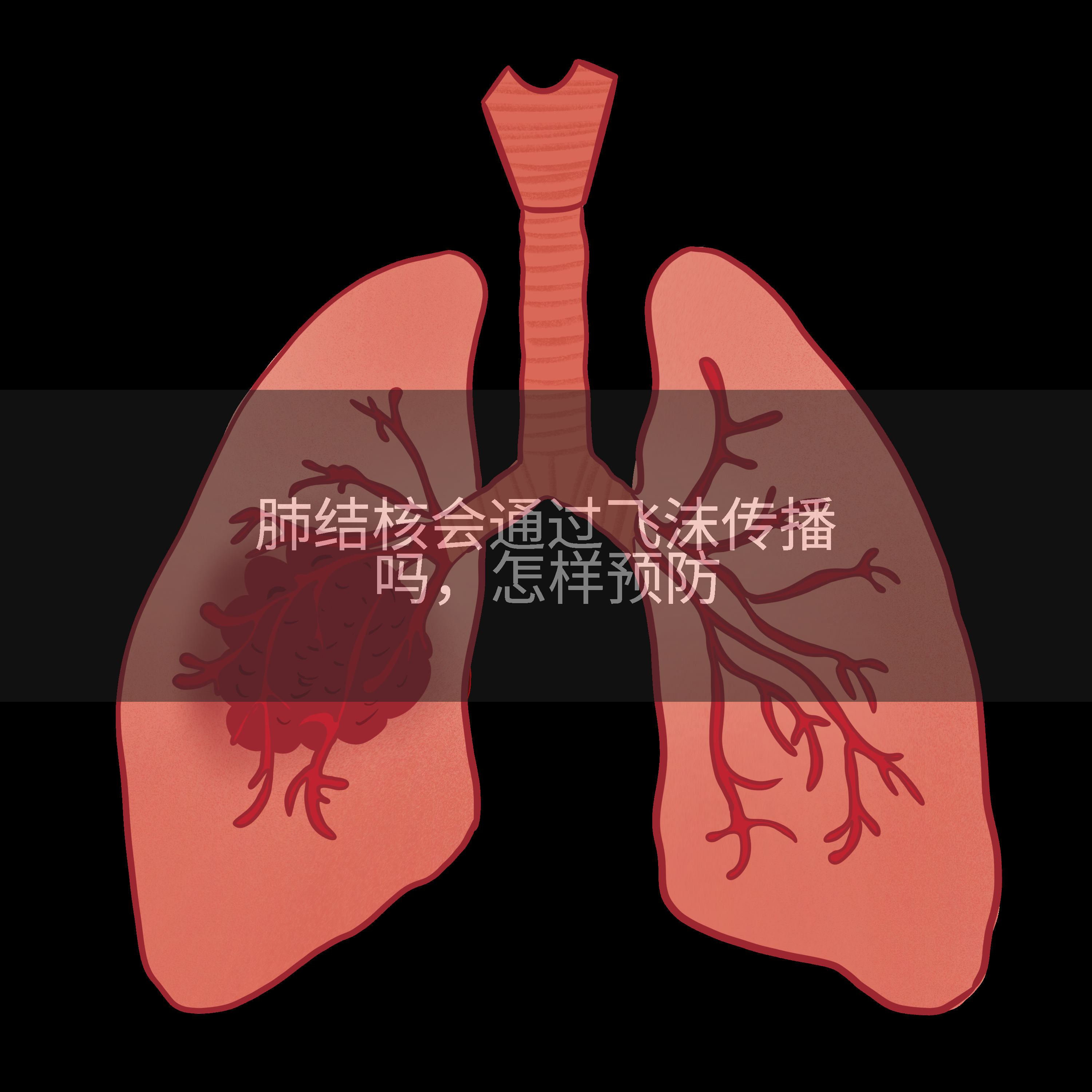 肺结核会通过飞沫传播吗，怎样预防