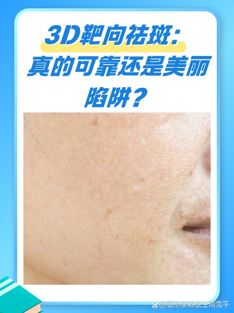 3D靶向祛斑：真的可靠还是美丽陷阱？